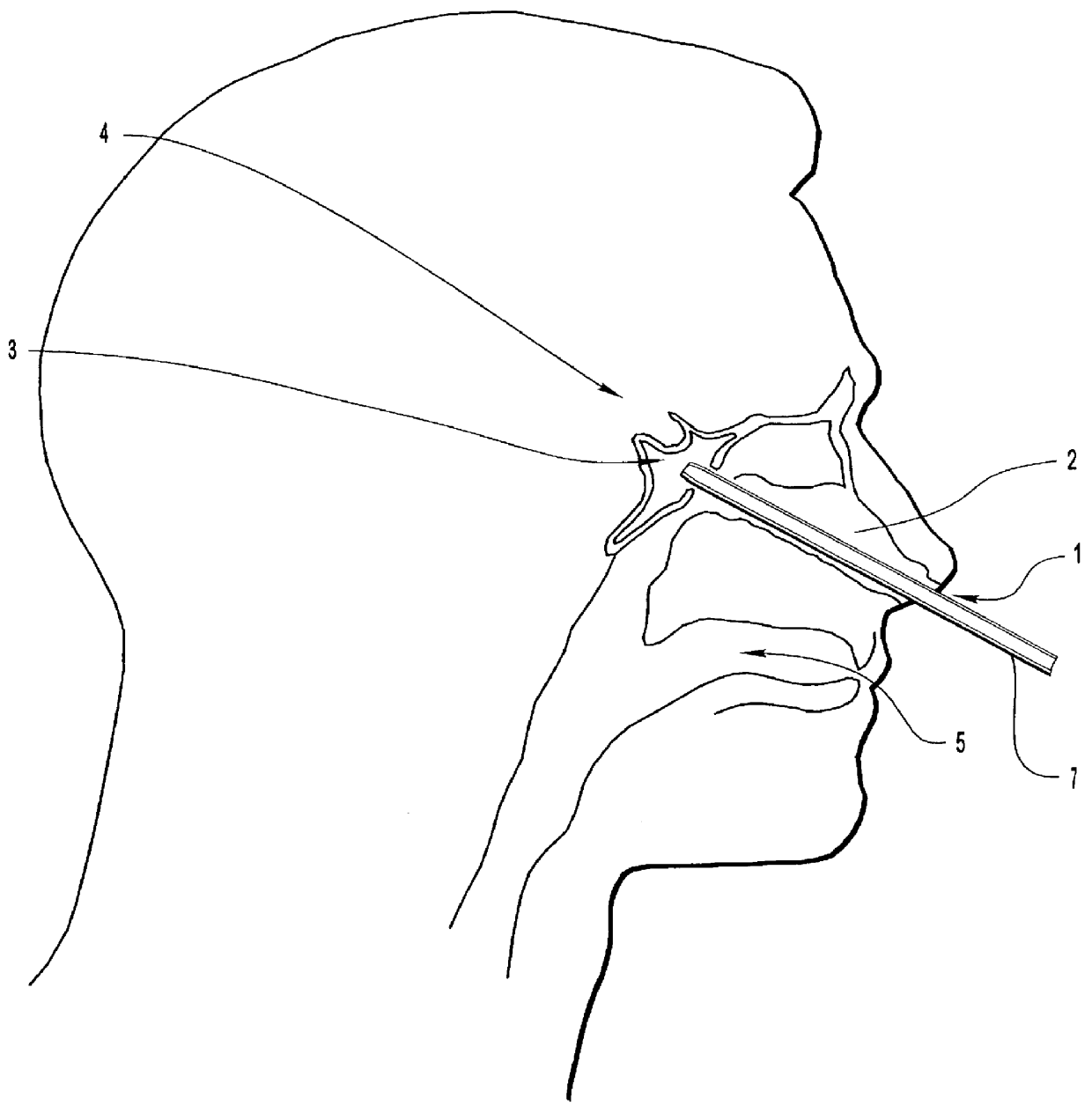 Method for inducing hypothermia