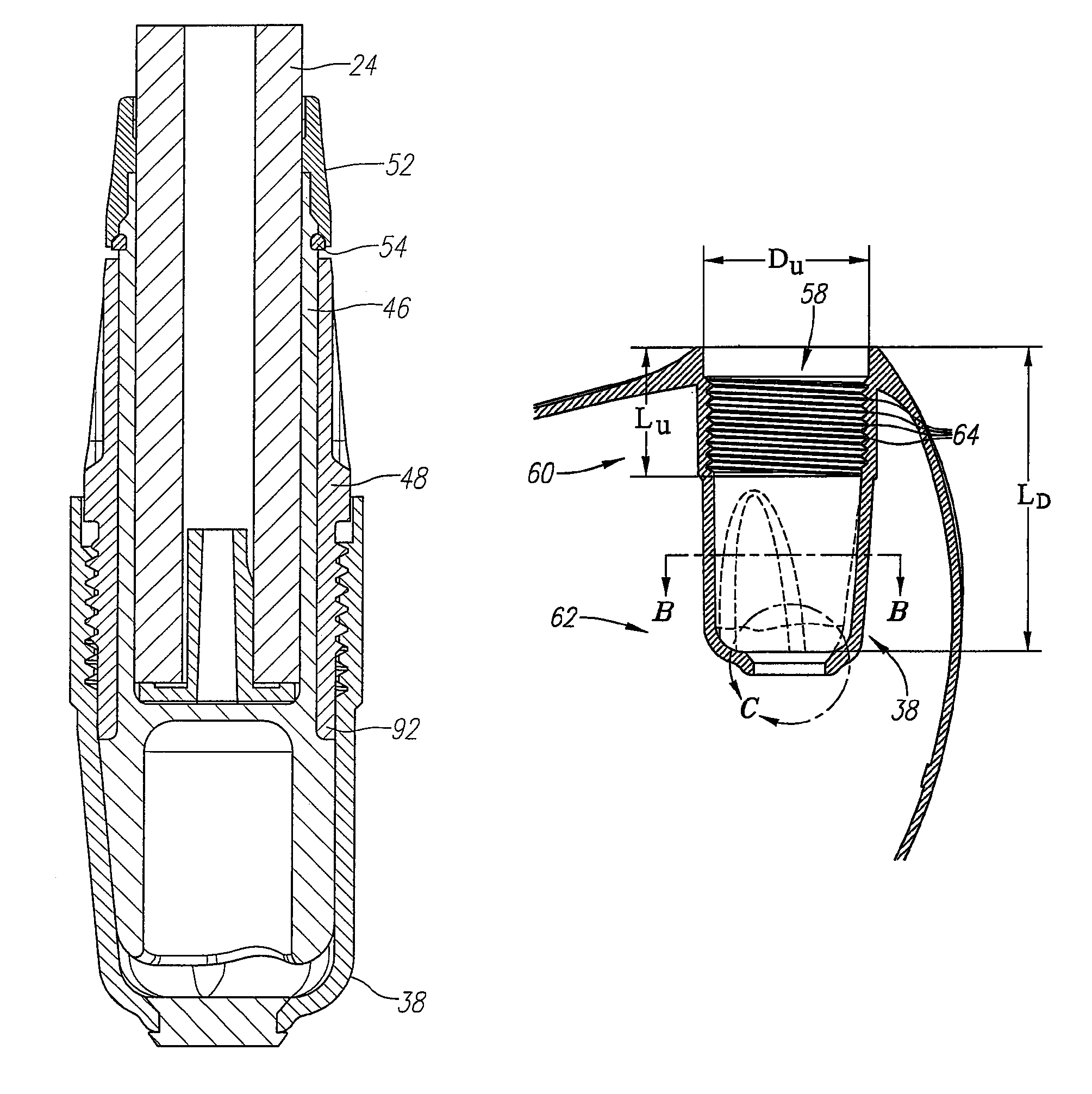 Golf club with removable components