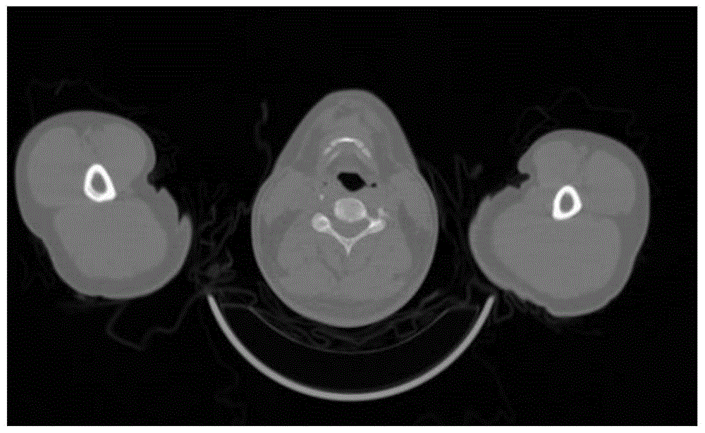 Method for positioning organs in medical image