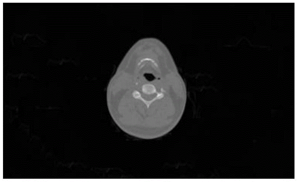 Method for positioning organs in medical image