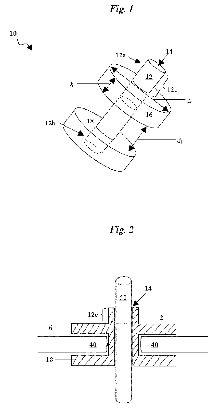 Percutaneous access device