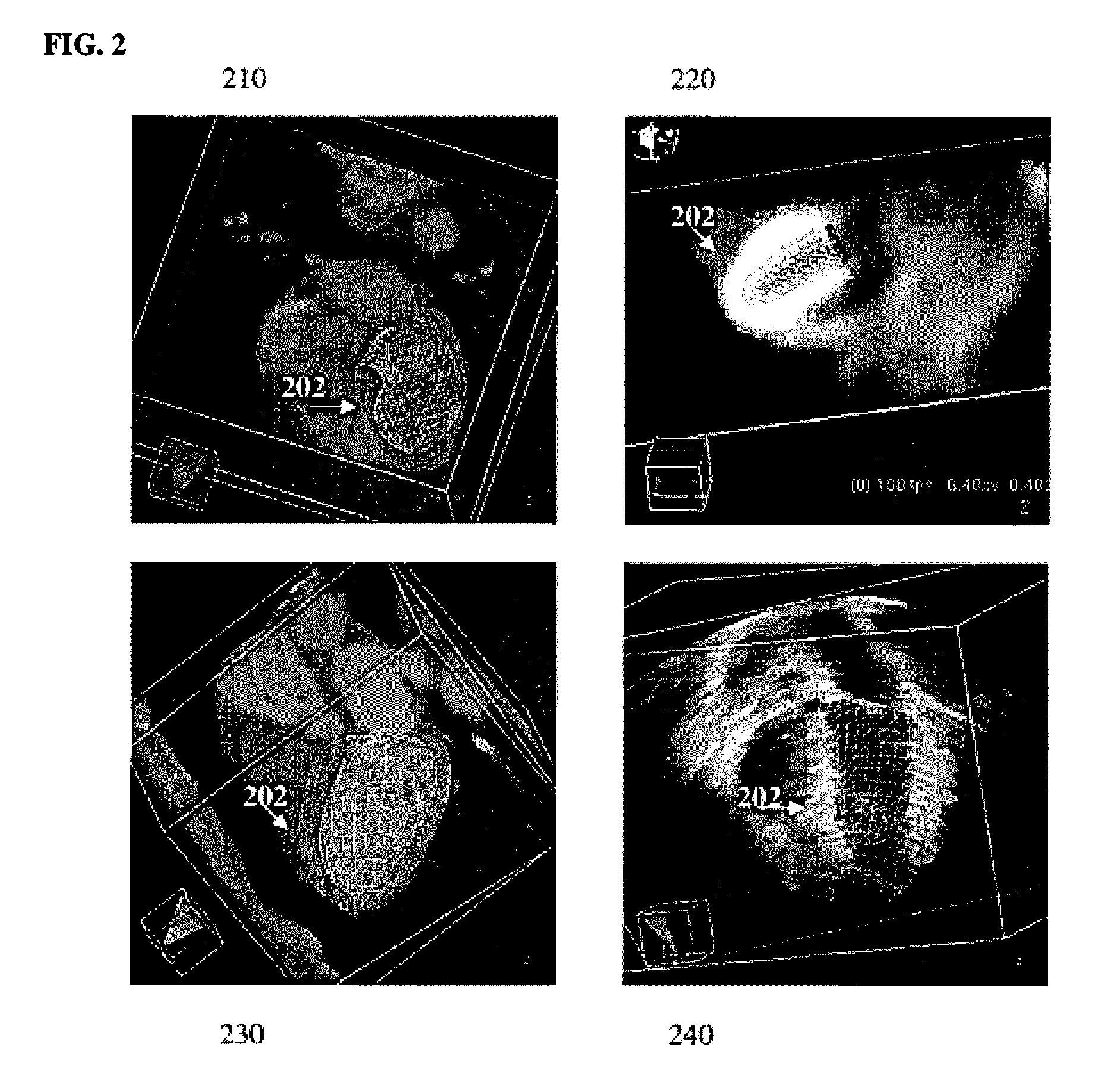 Method and system for physiological image registration and fusion