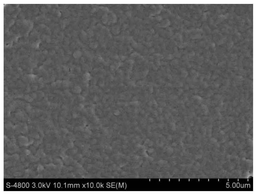 Bionic anticoagulant zwitterionic microgel coating and preparation method thereof