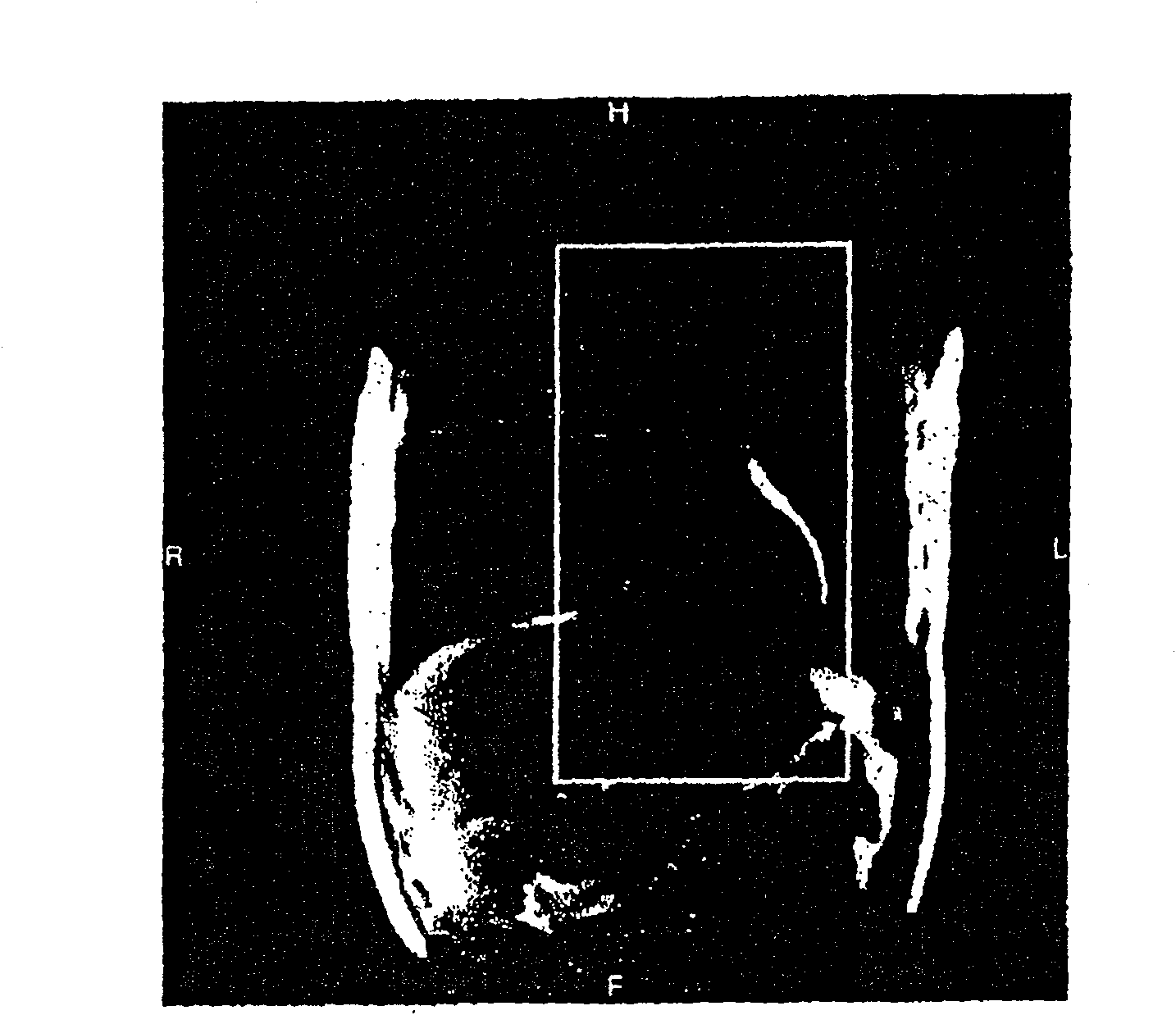 MRI device and method