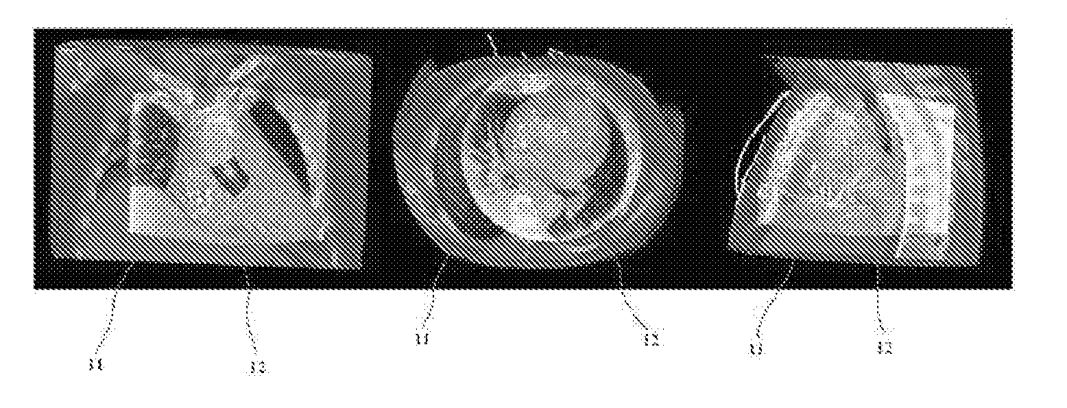 Image Fusion for Interventional Guidance