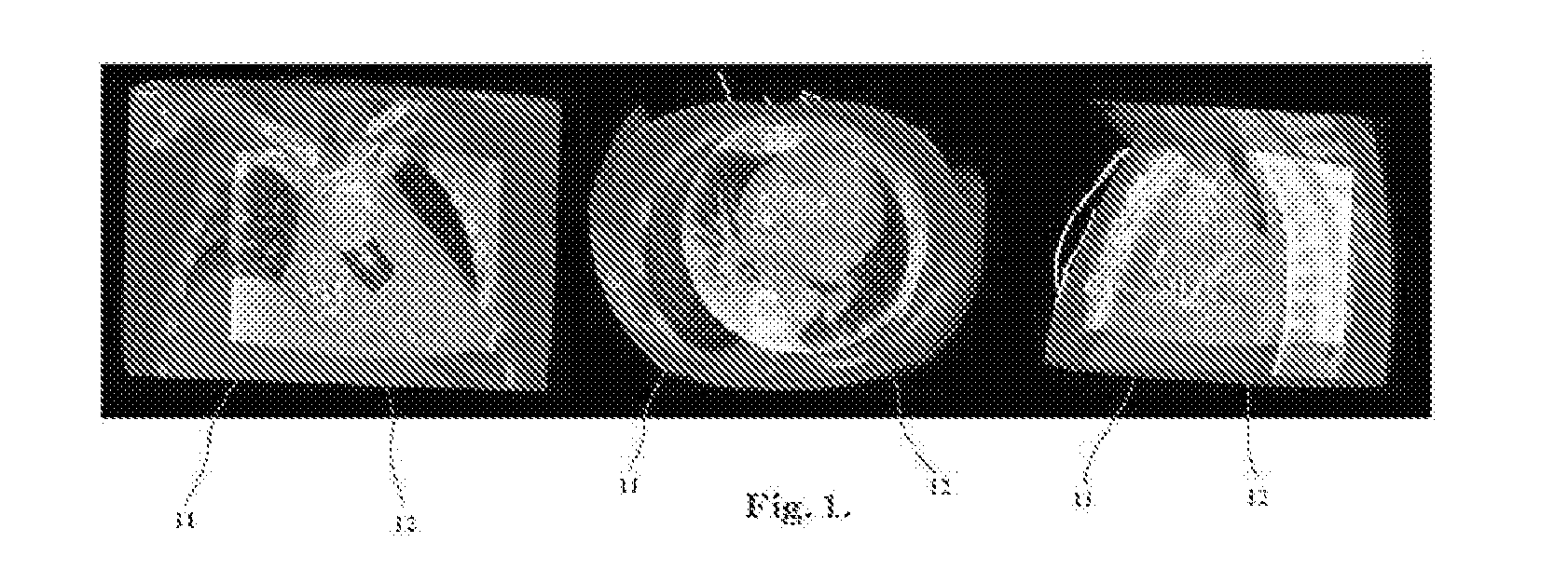 Image Fusion for Interventional Guidance