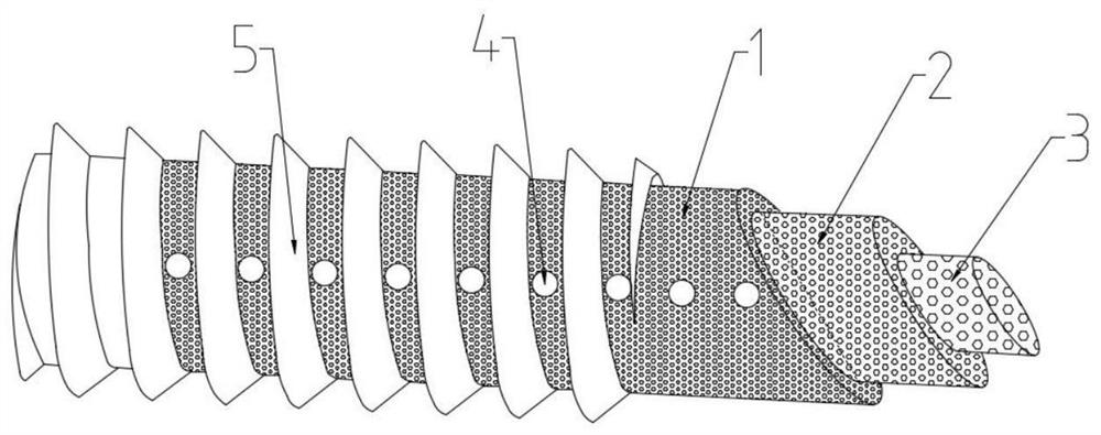 Bone filling prosthesis and preparation technology thereof