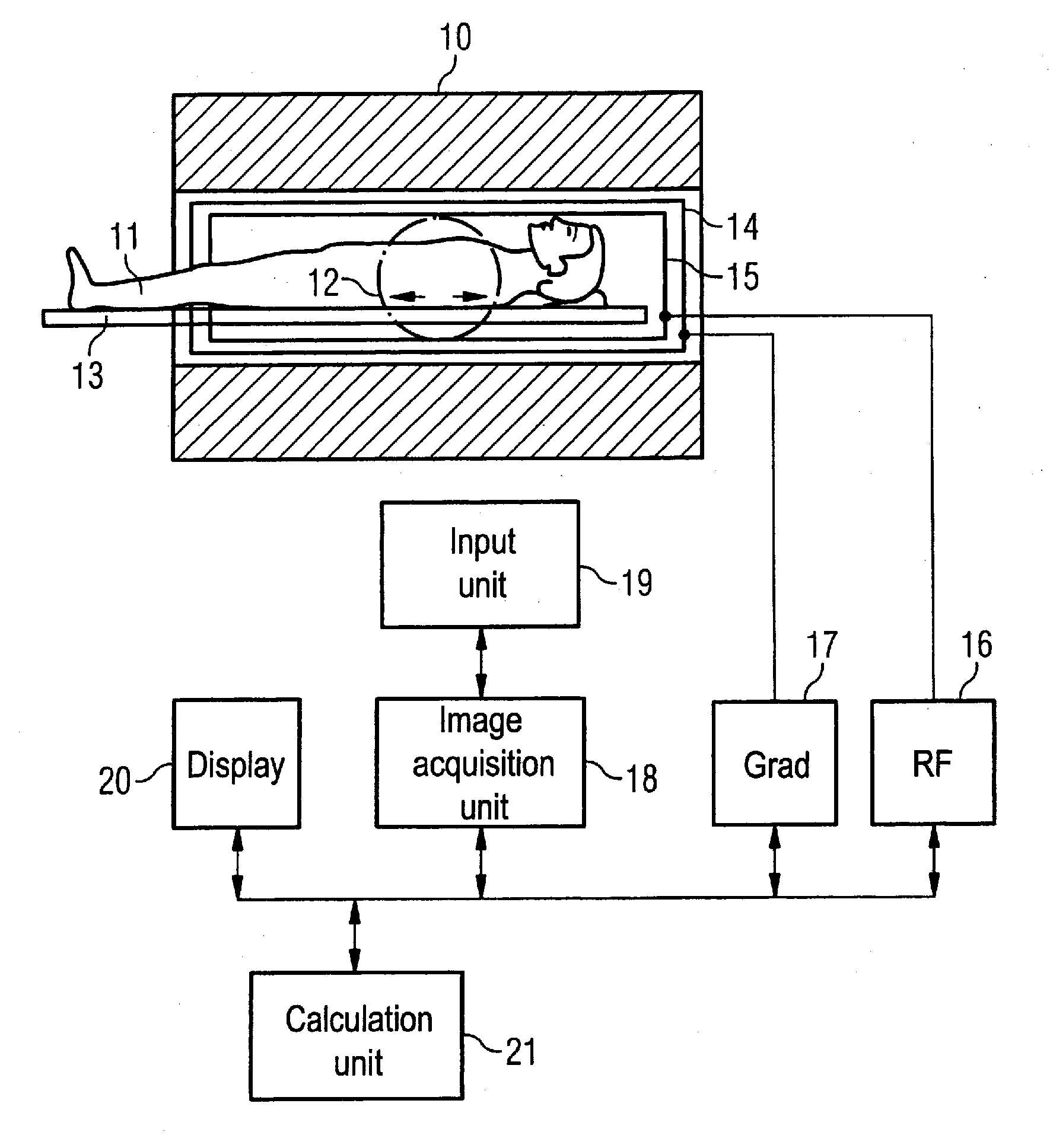 Method and magnetic resonance system to optimize mr images