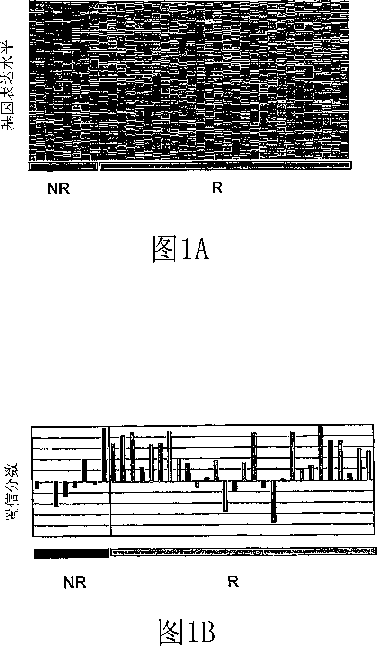 Methods and systems for diagnosis, prognosis and selection of treatment of leukemia