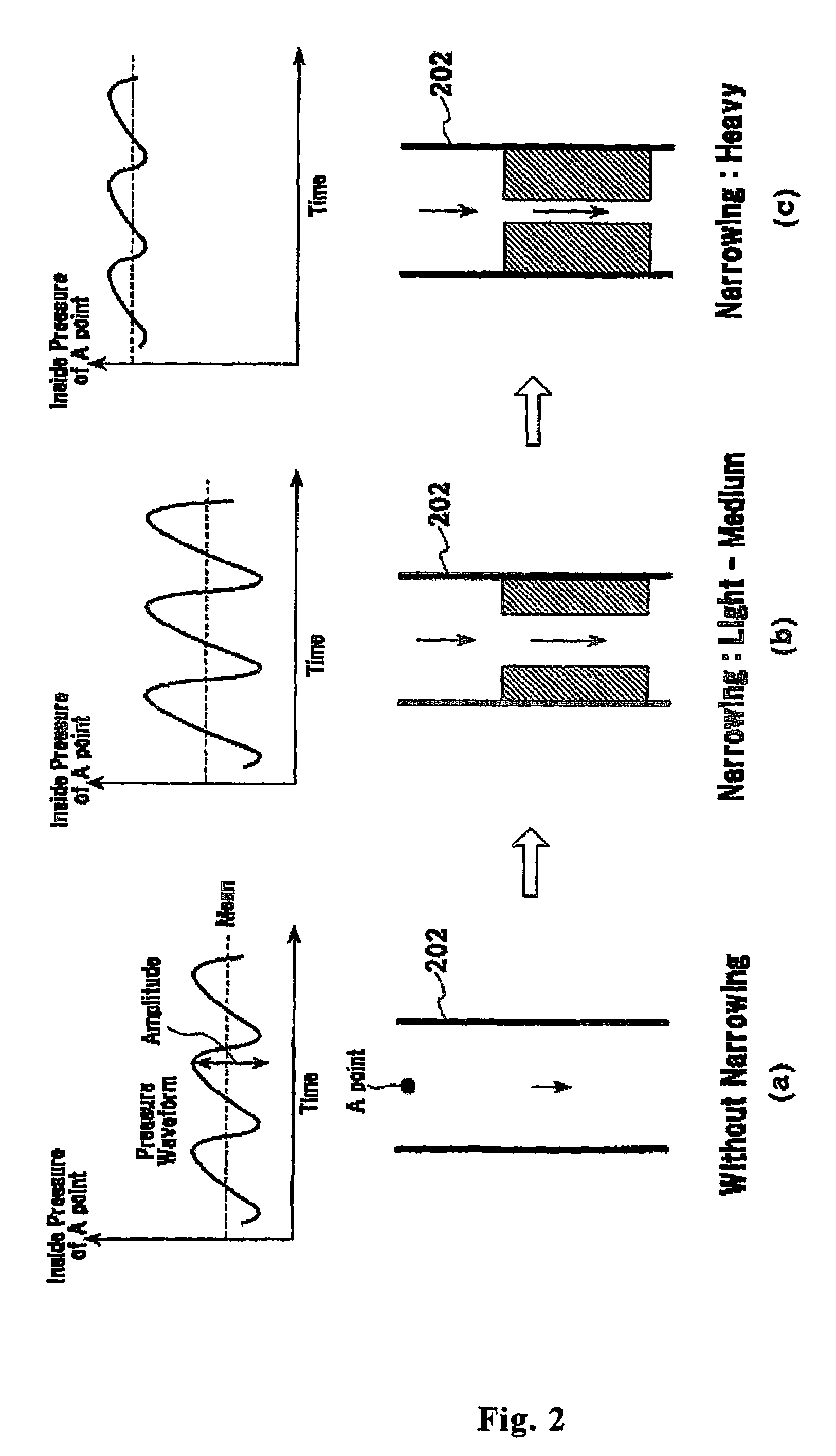 Method for detecting filter clogging by using pressure information, apparatus for monitoring filter clogging and bed-side system