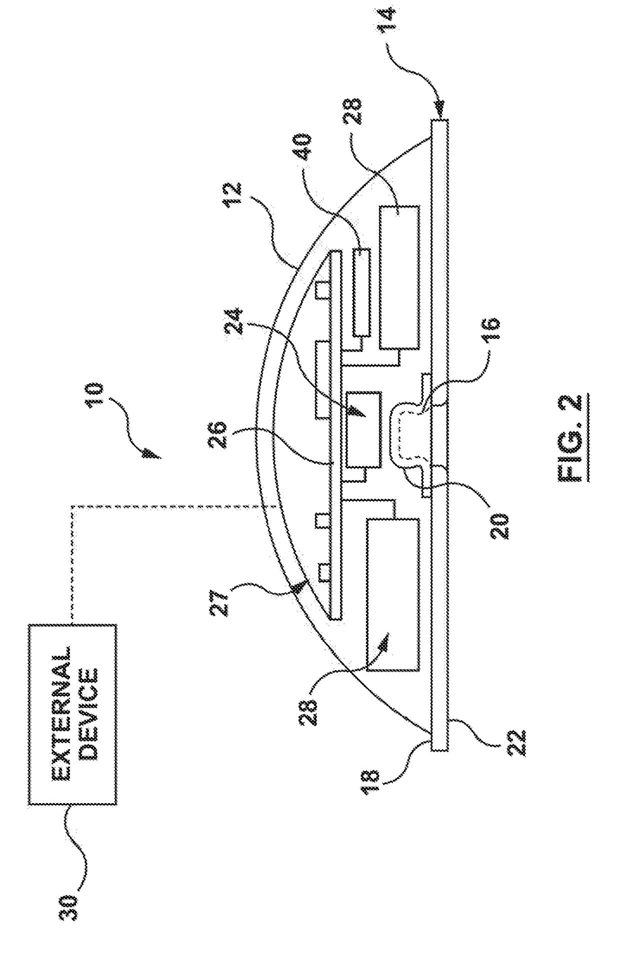 Cardiac monitor system and method for home and telemedicine application