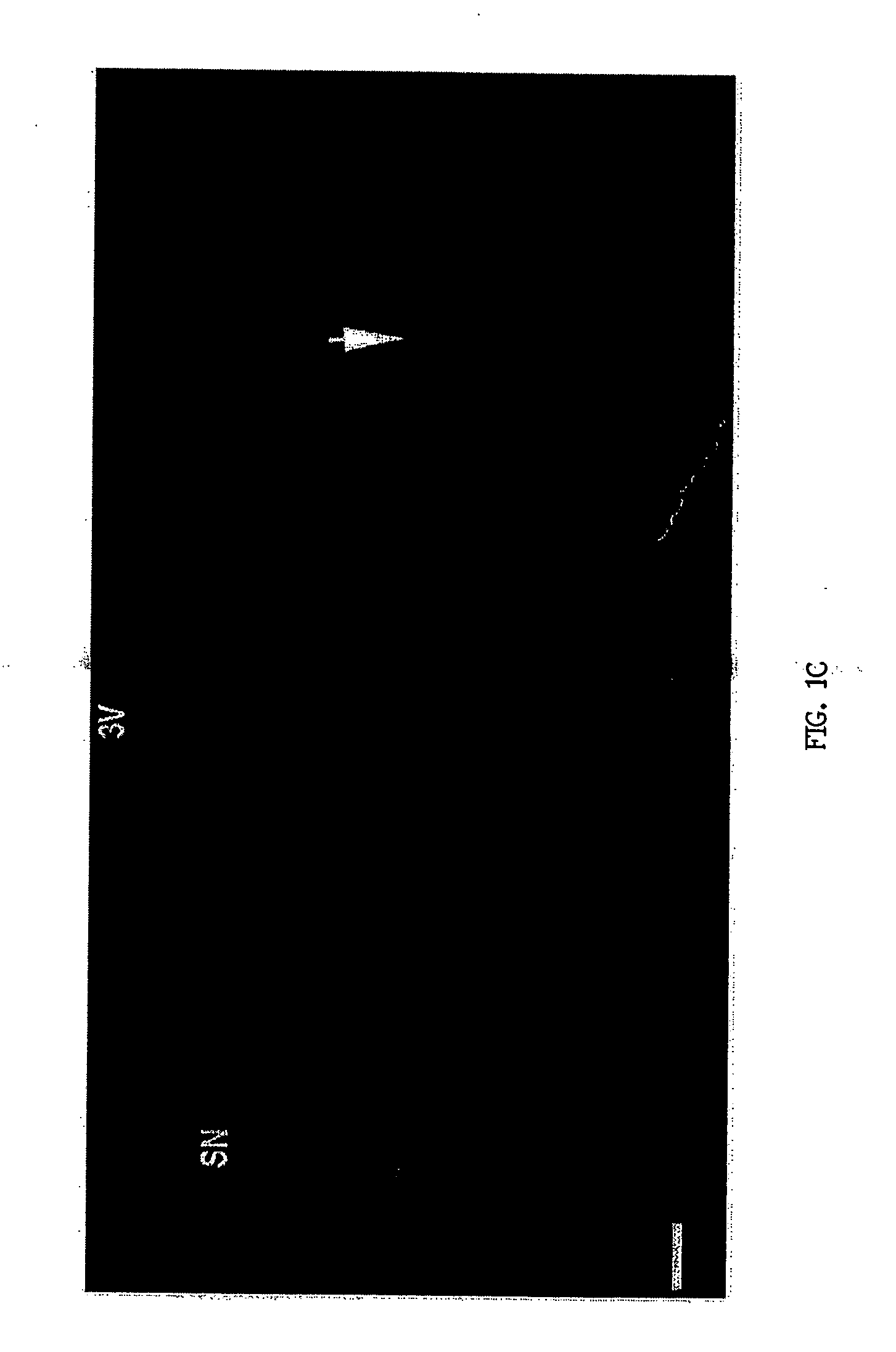 Methods and compositions for treating Parkinson's disease