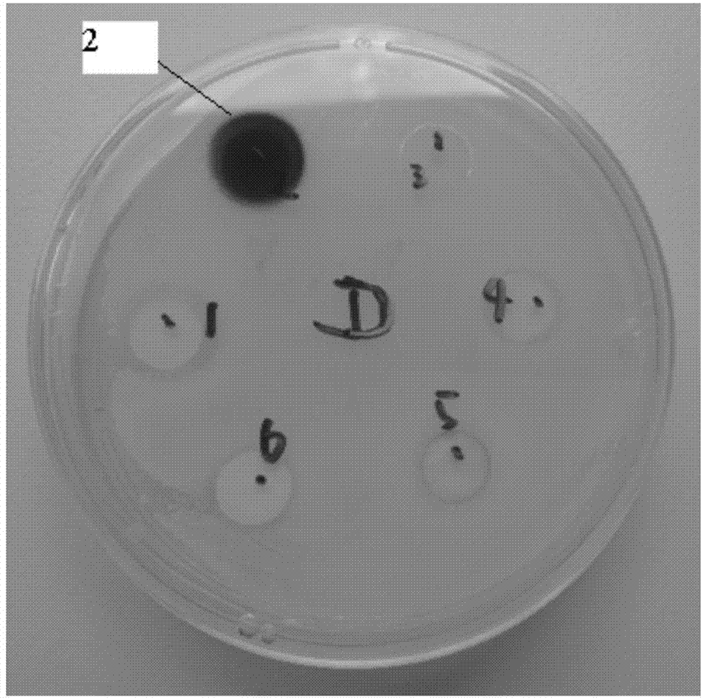 Epidural-subcutaneous buried type analgesia pump with anti-infection function