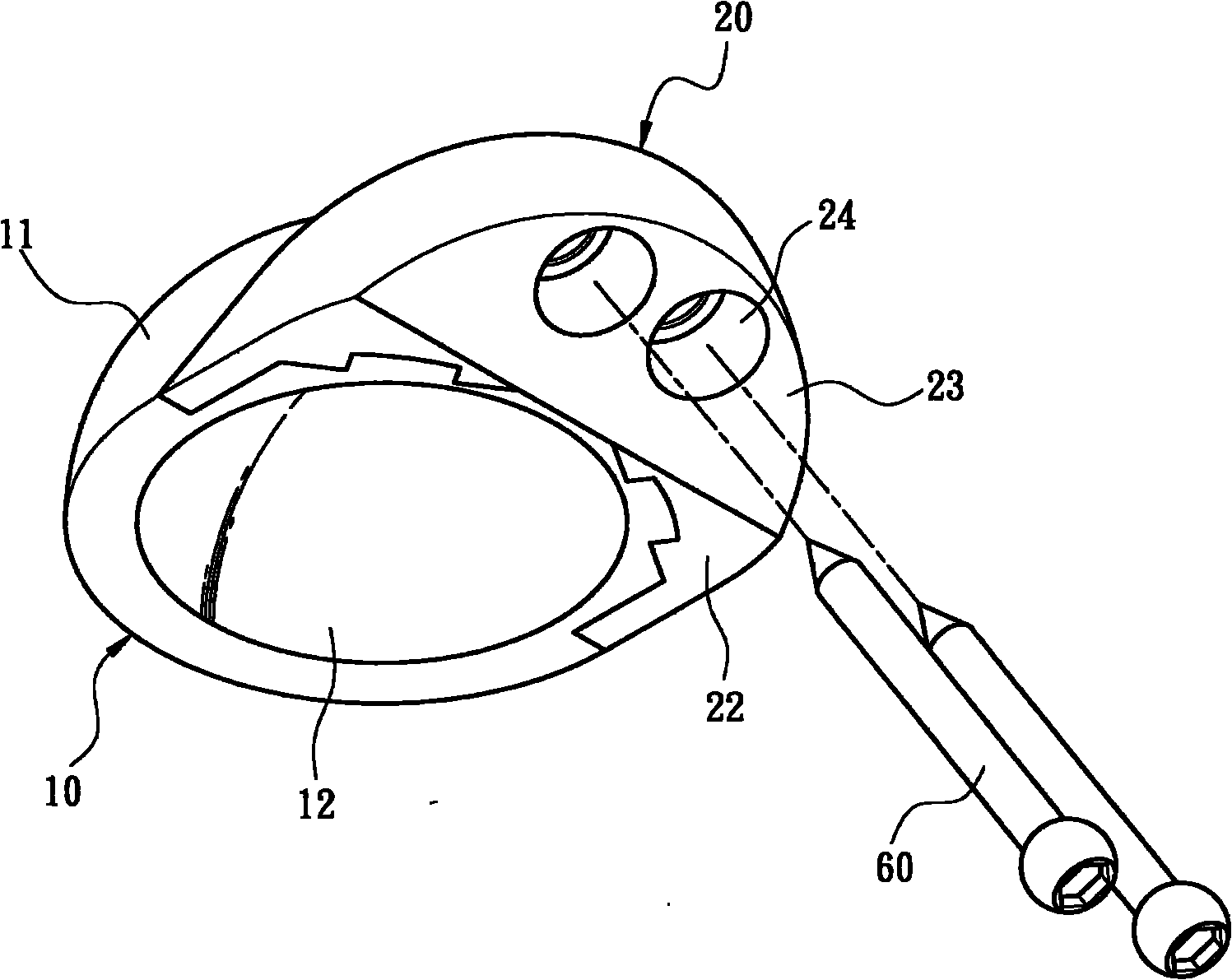 Modularized manual acetabulum cup