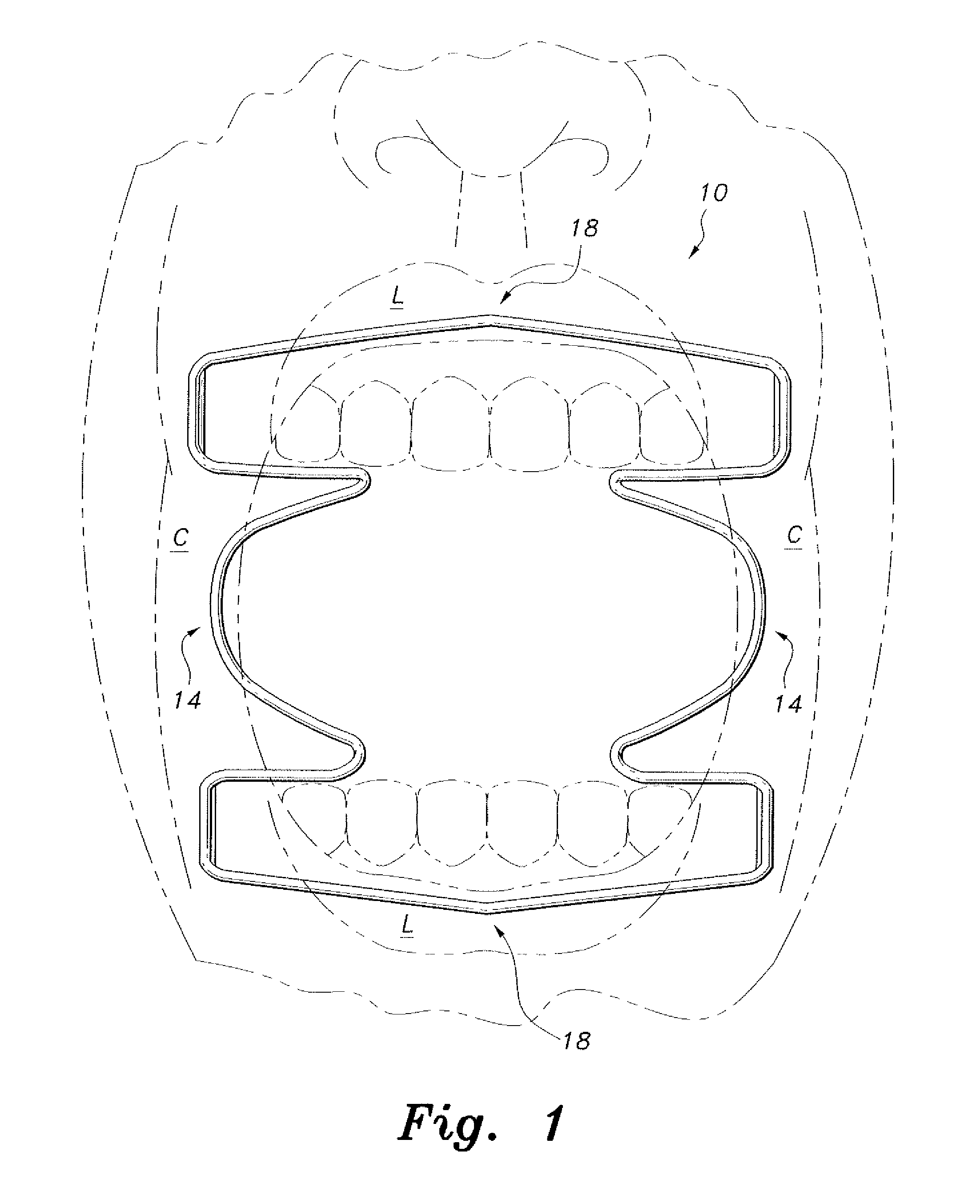 Oral retractor