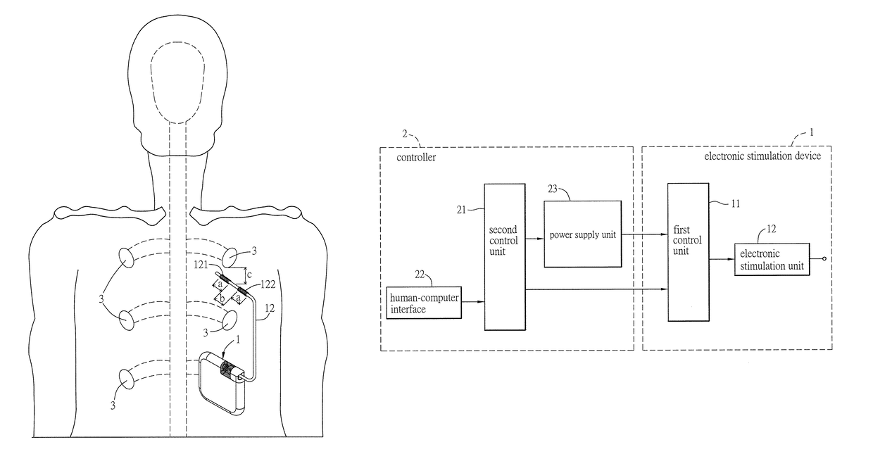 Method for reducing overactive bladder syndrome and computer-readable medium thereof