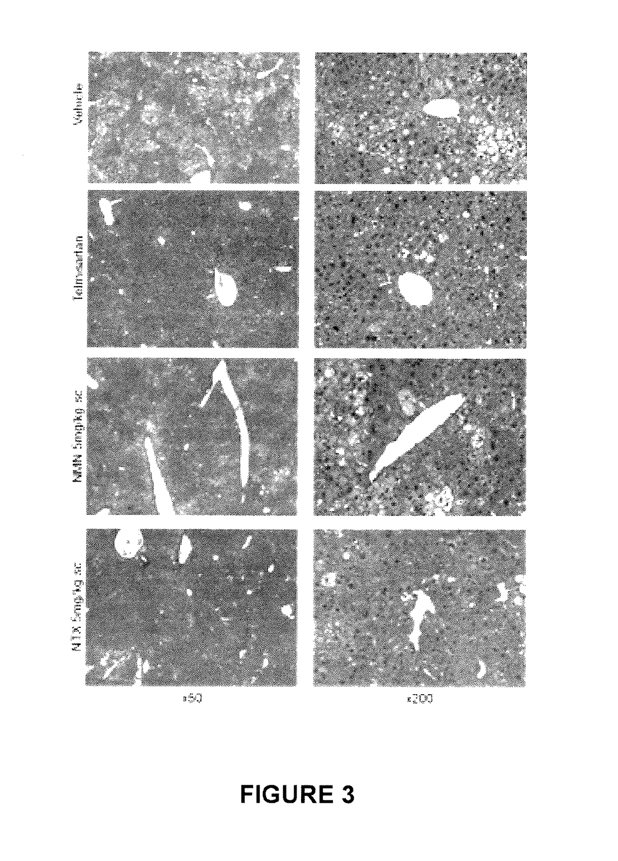 Use of nalmefene in non-alcoholic steatohepatitis