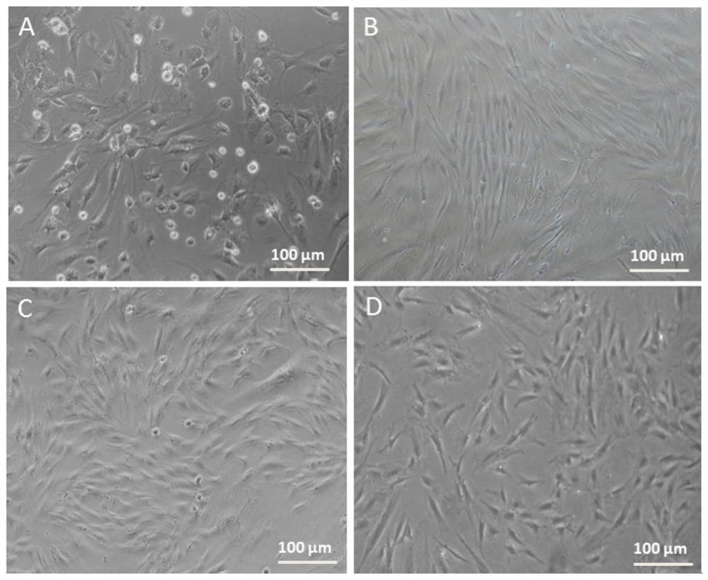 A method for inducing human adipose stem cells to differentiate into Leydig cells with small molecules