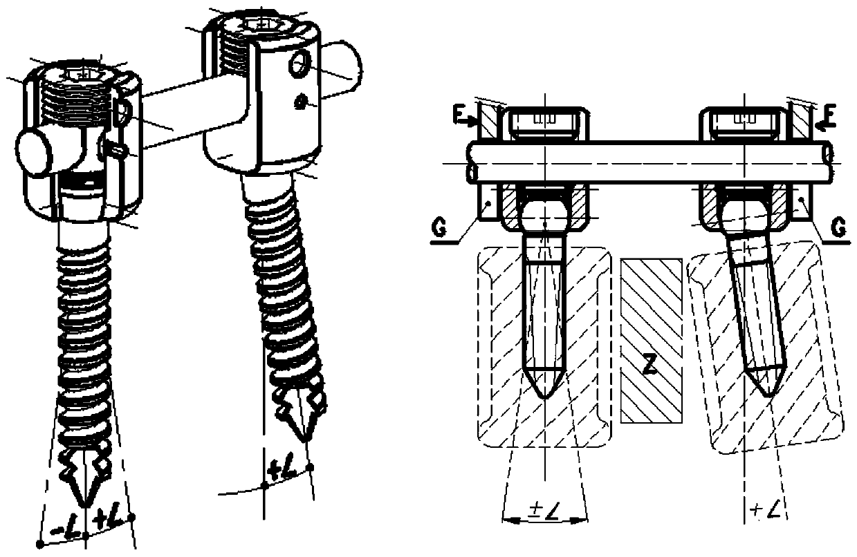 Dynamic pedicle screw neutral pressurization and limiting tool of dynamic pedicle screw