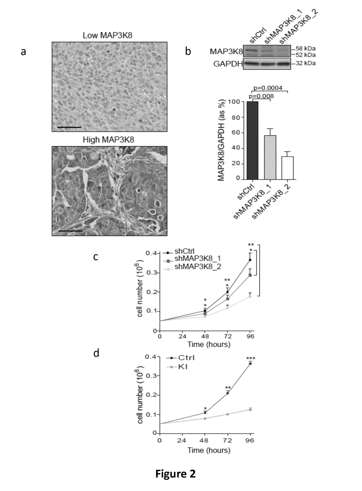 Map3k8 as a marker for selecting a patient affected with an ovarian cancer for a treatment with a mek inhibitor