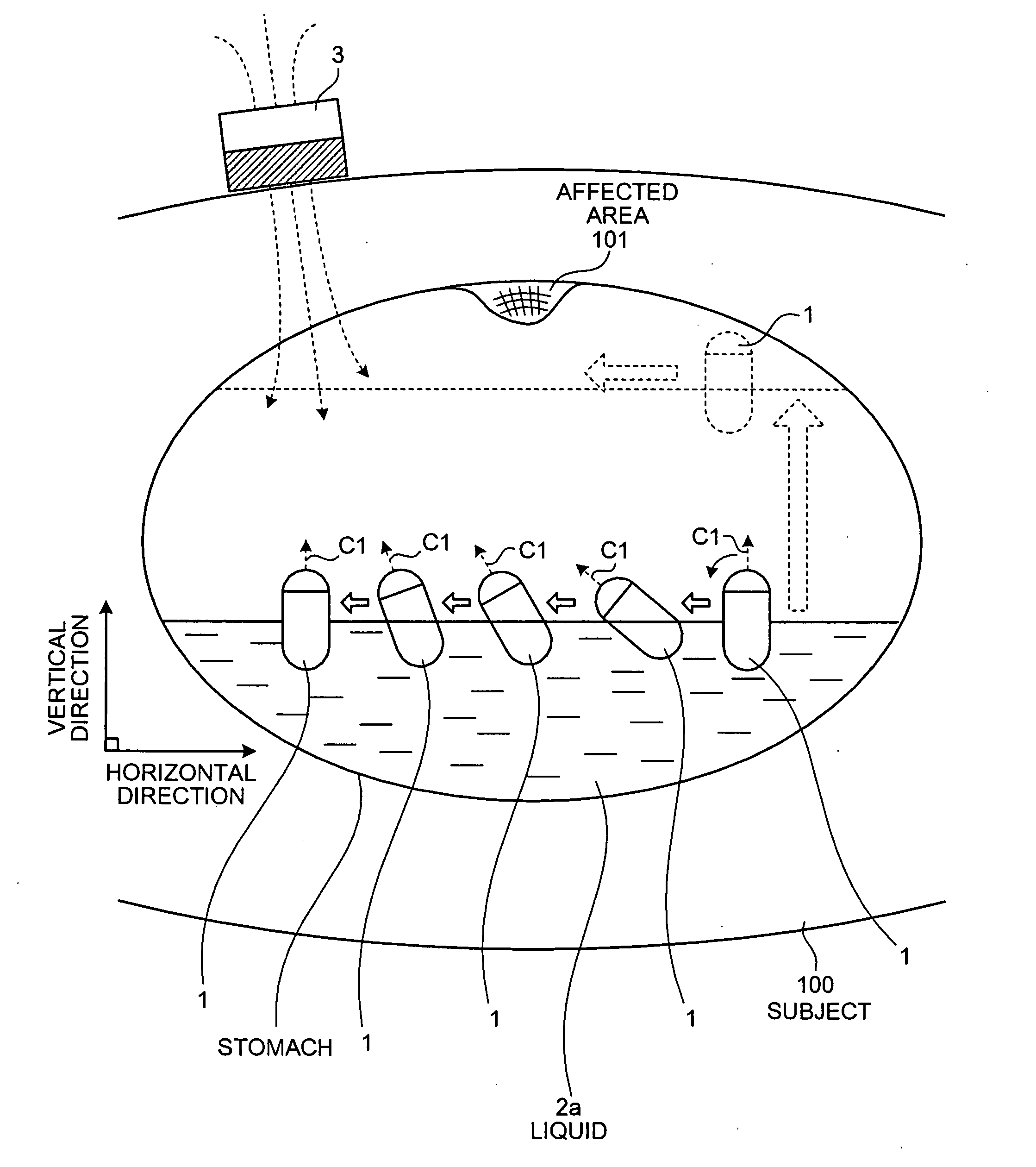 Body-insertable device system and in-vivo observation method