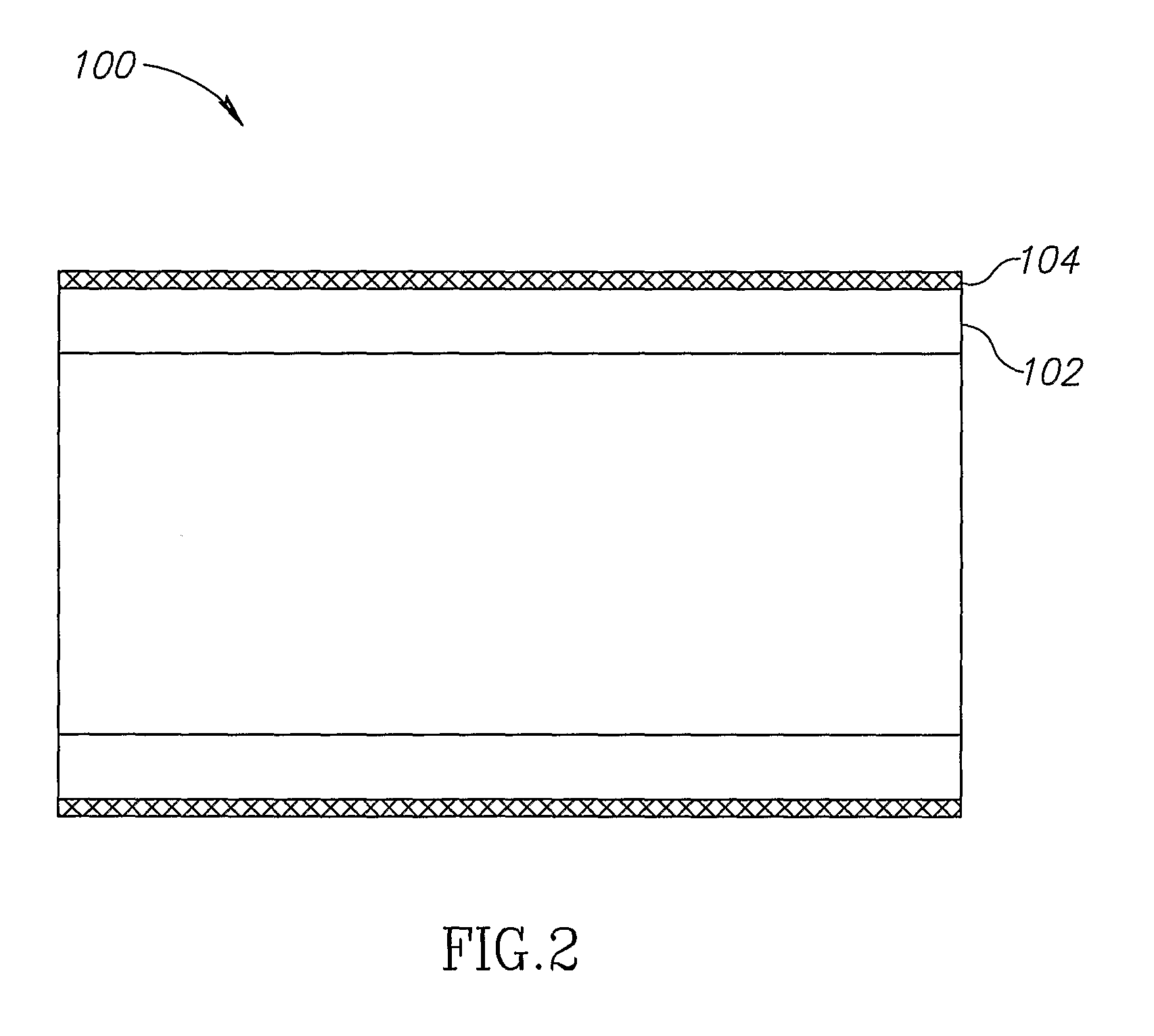 Stent Apparatuses for Treatment Via Body Lumens and Methods of Use