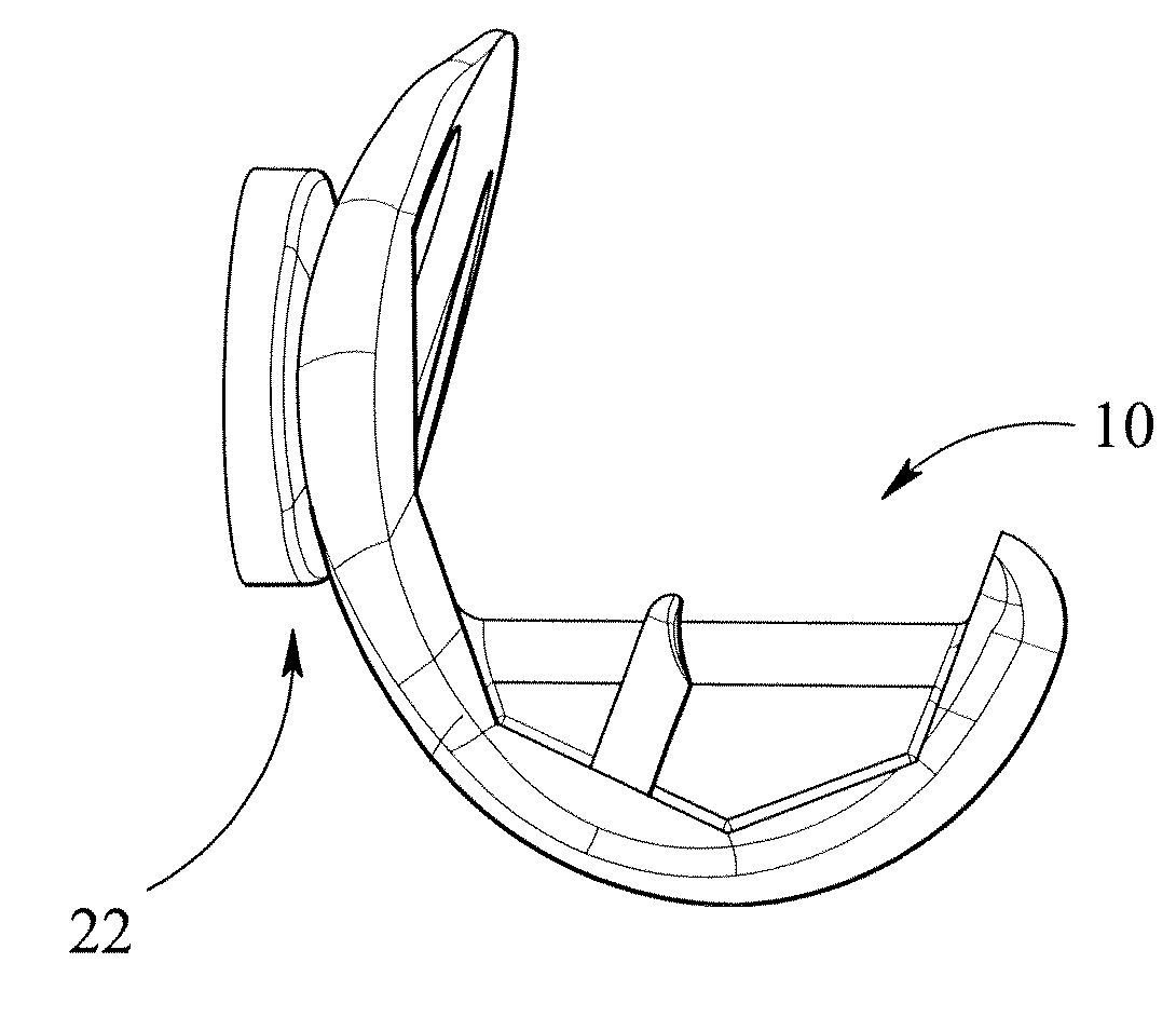 Knee prostheses