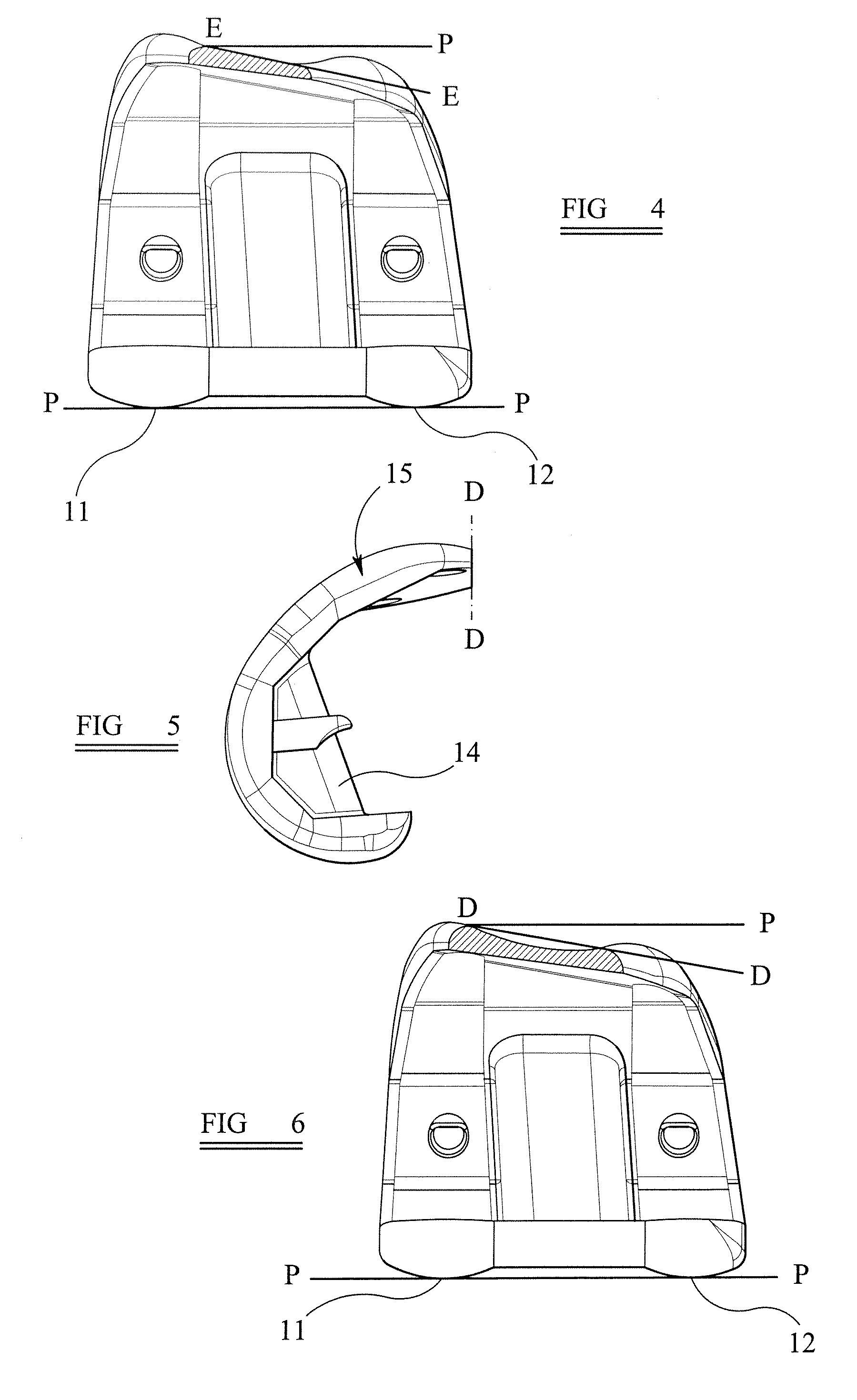 Knee prostheses