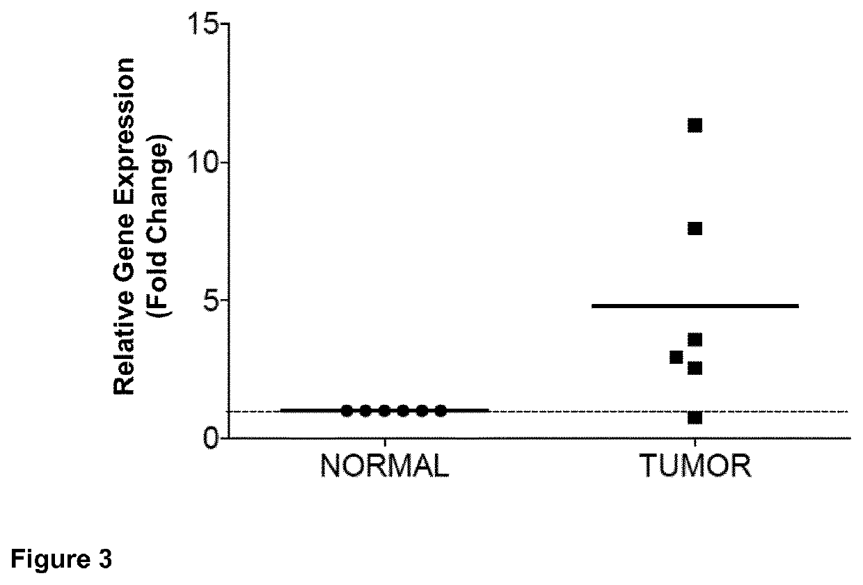 Use of the tas1r3 protein as a marker for therapeutic, diagnostic, and/or prognostic purposes for tumors that express said protein