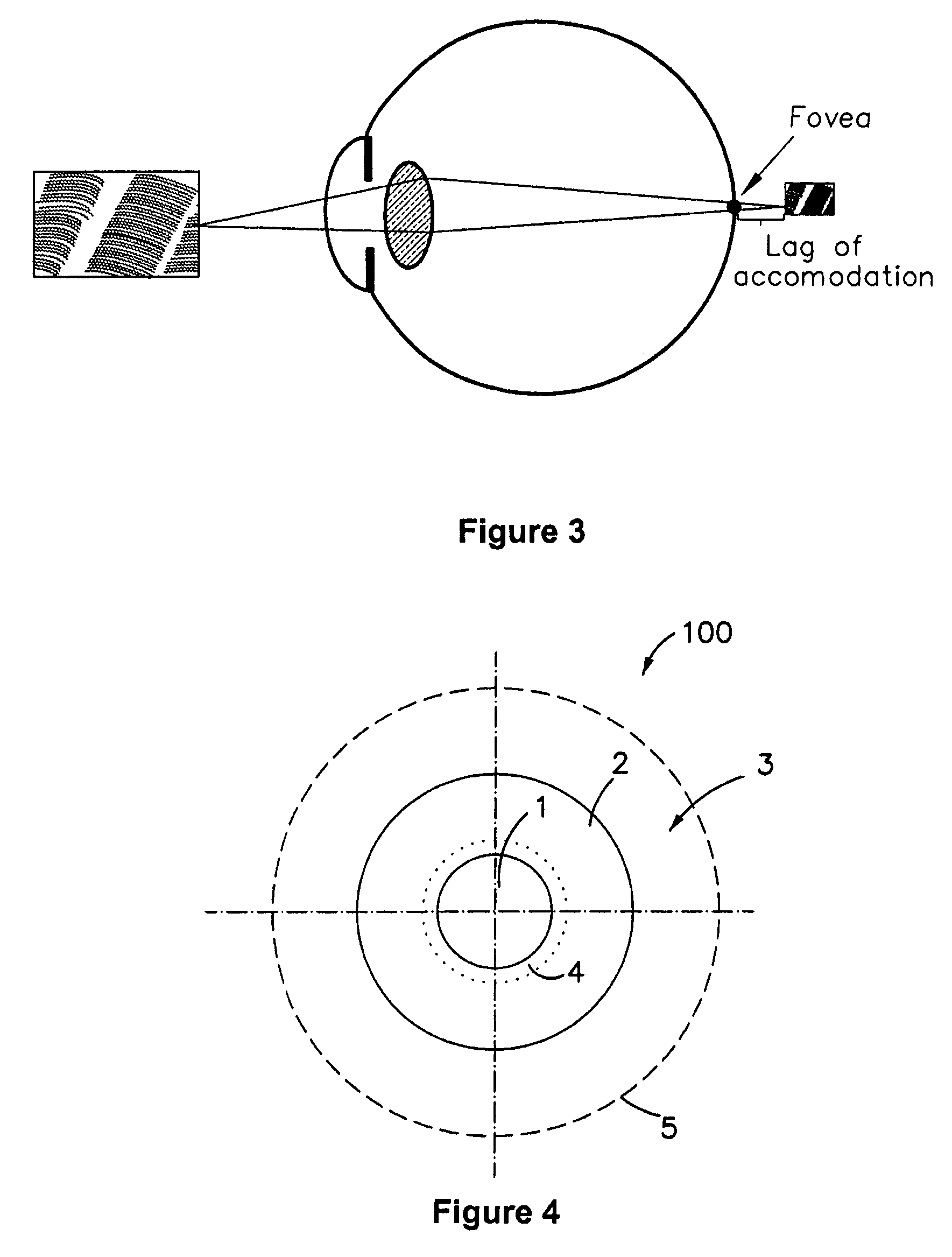 Contact lenses for myopic eyes and methods of treating myopia