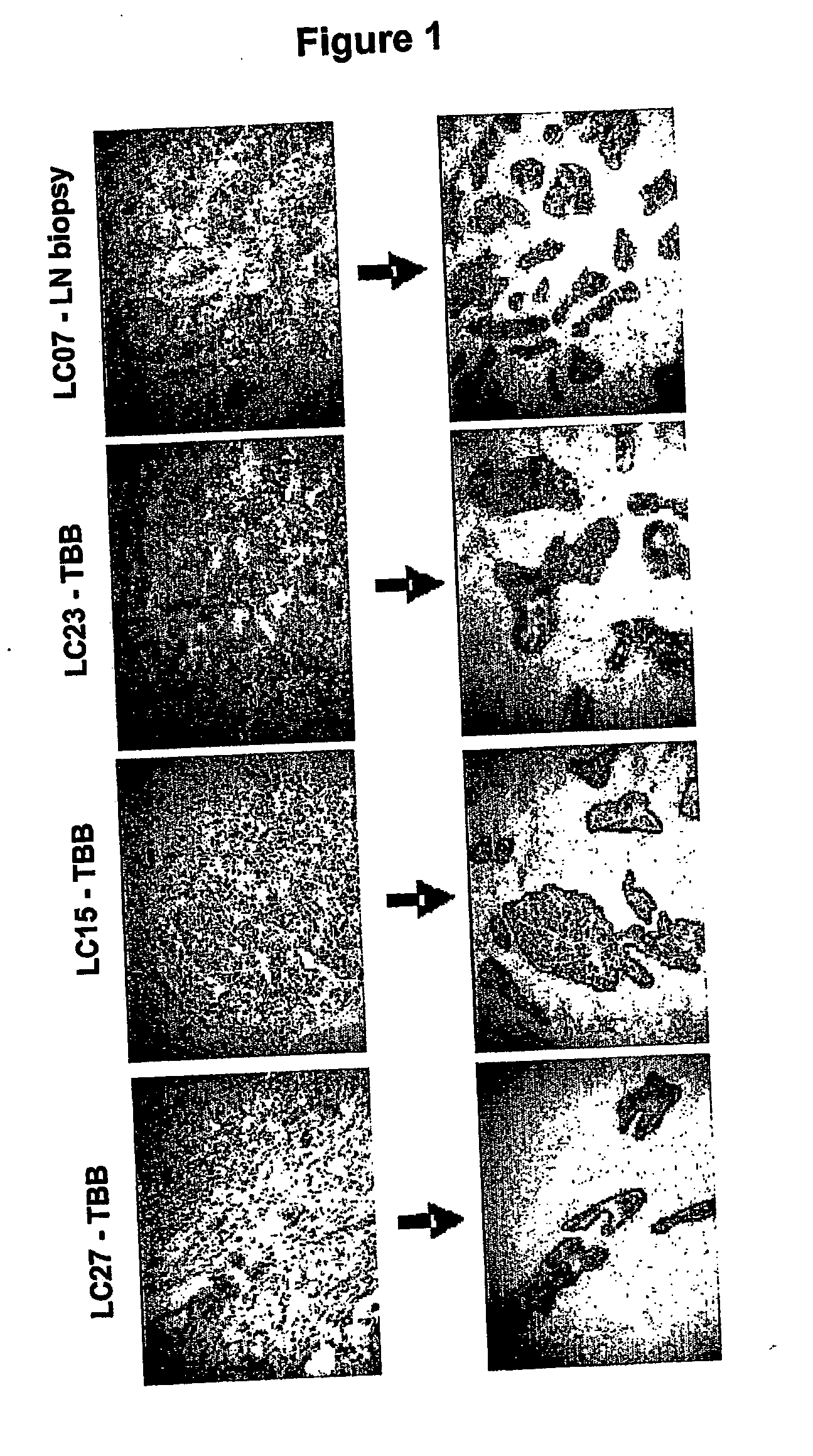 Markers for responsiveness to an erbB receptor tyrosine kinase inhibitor