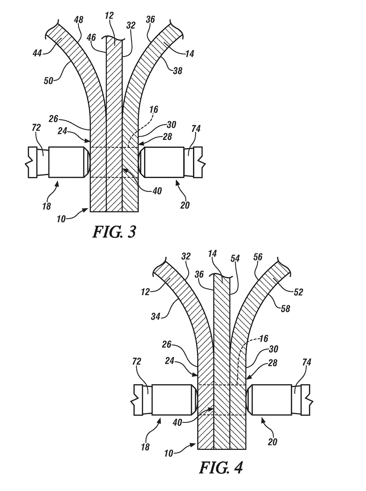 External heat assisted welding of dissimilar metal workpieces