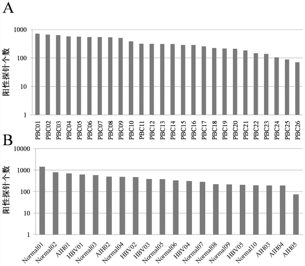 Specific autoantigen of primary biliary cirrhosis (PBC) and application thereof