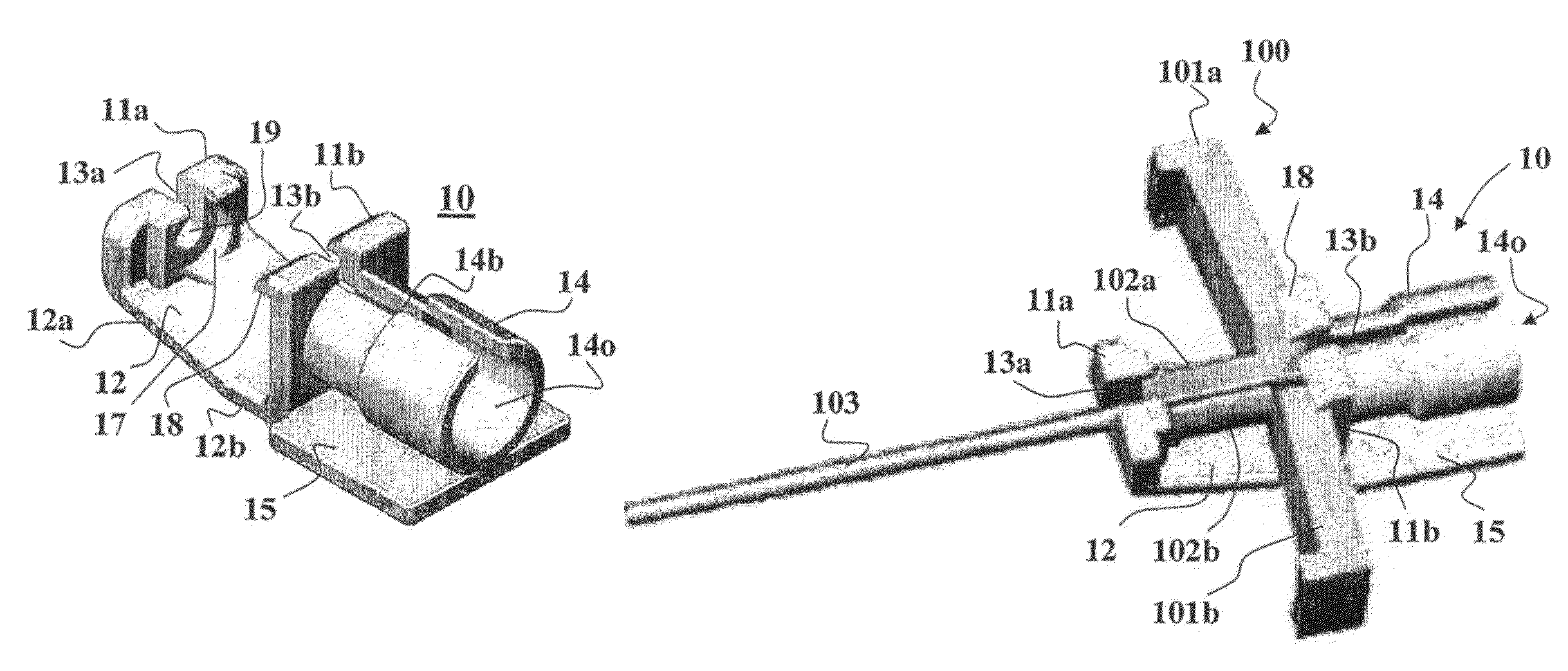 Removable adapter for a splittable introducer and method of use thereof