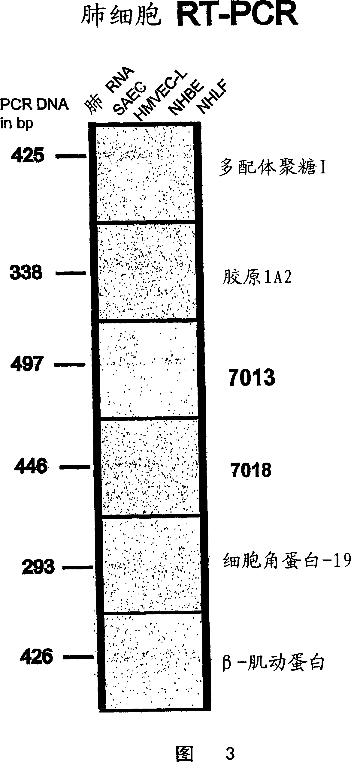 Gene markers for lung cancer