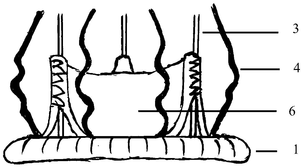 Aortic biovalve with compressible suture edge