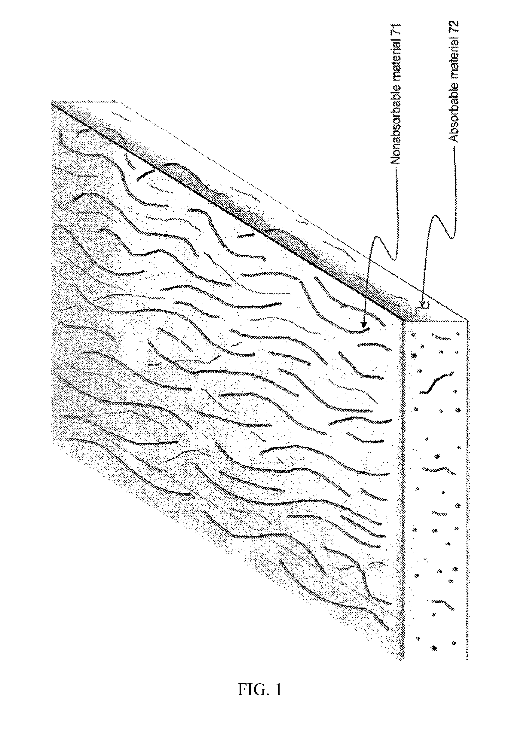 Supporting and forming transitional material for use in supporting prosthesis devices, implants and to provide structure in a human body