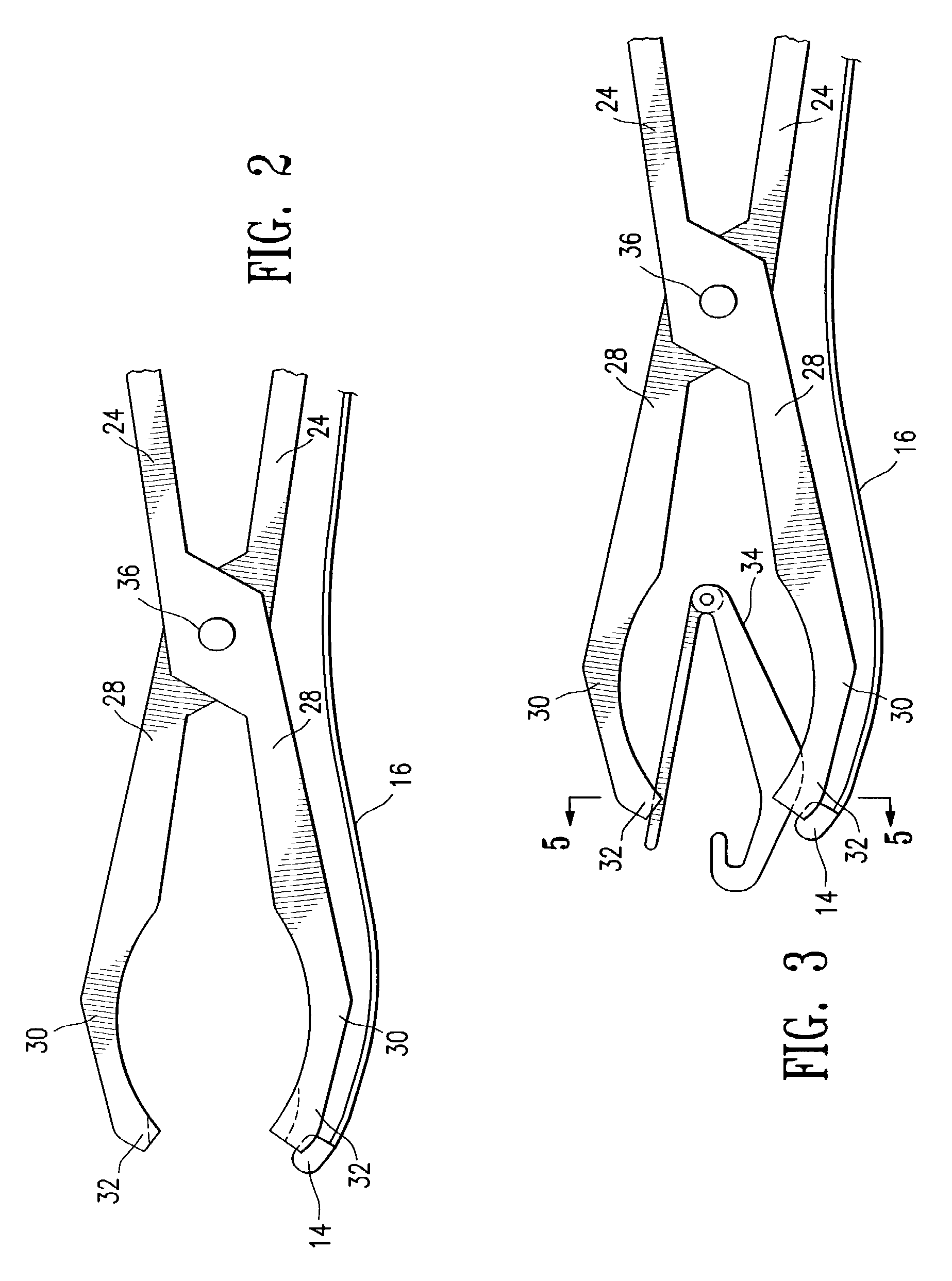 Luminal clip applicator with sensor and methods for occluding body lumens