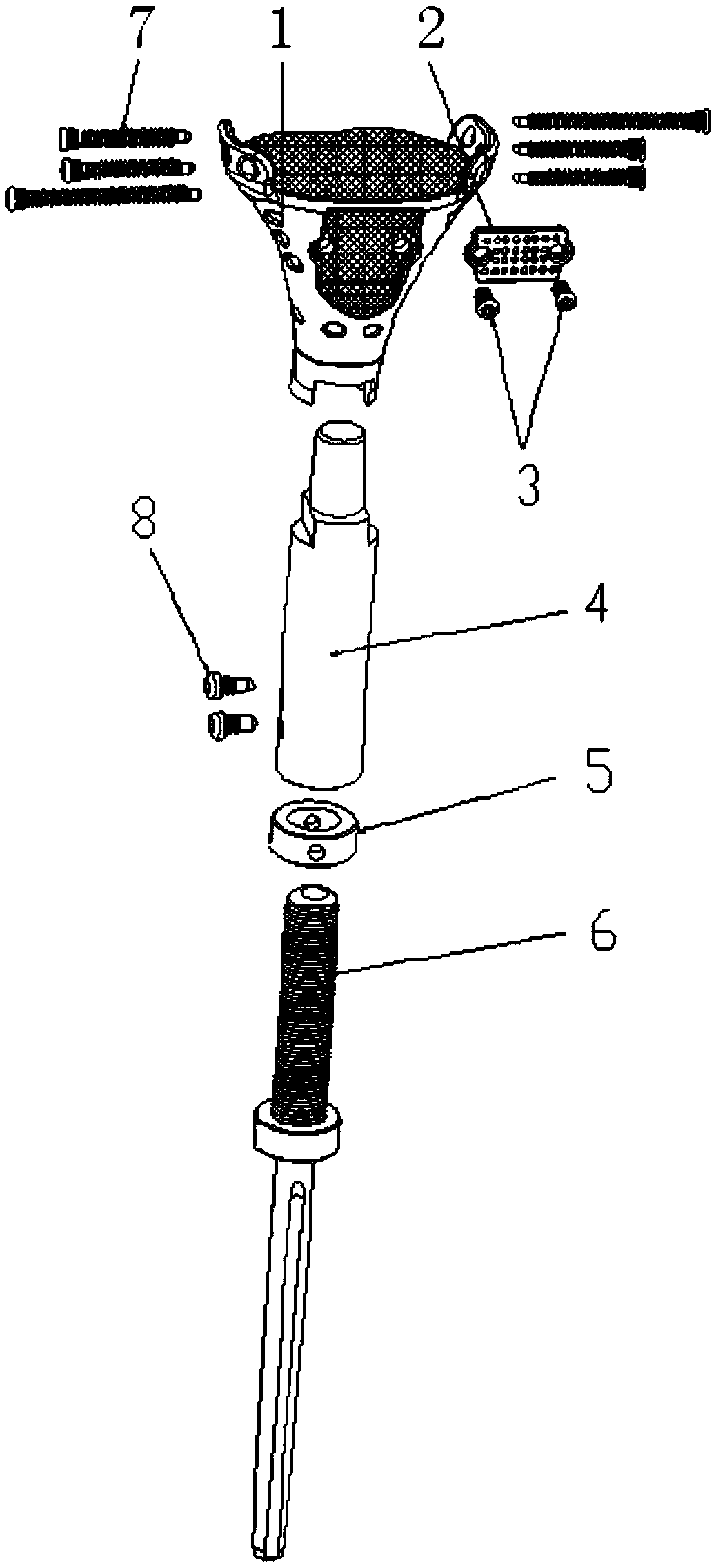 An extensible prosthesis for tibial tumor knee joint with preserved articular surface