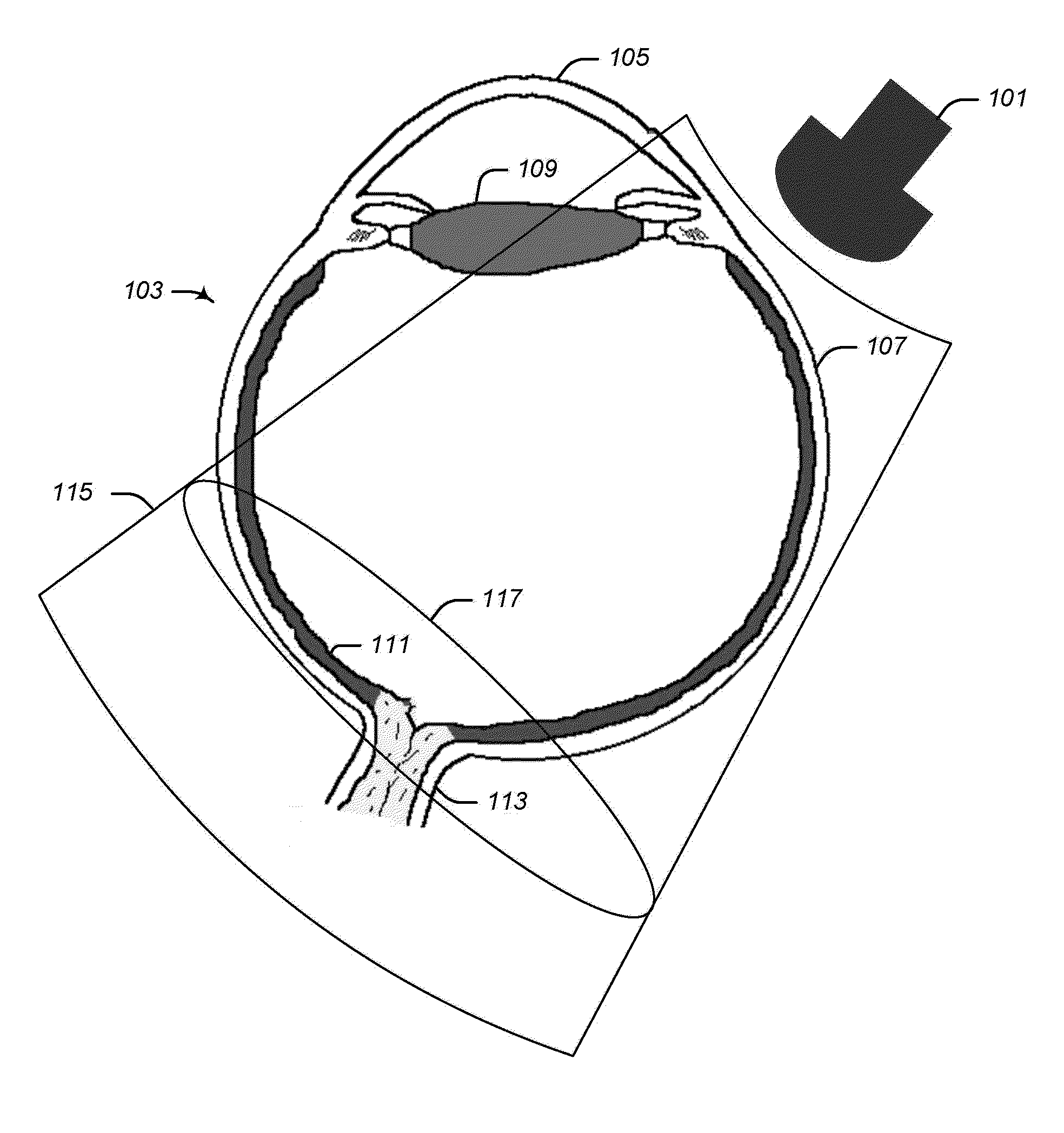 High frequency ultrasonic convex array transducers and tissue imaging