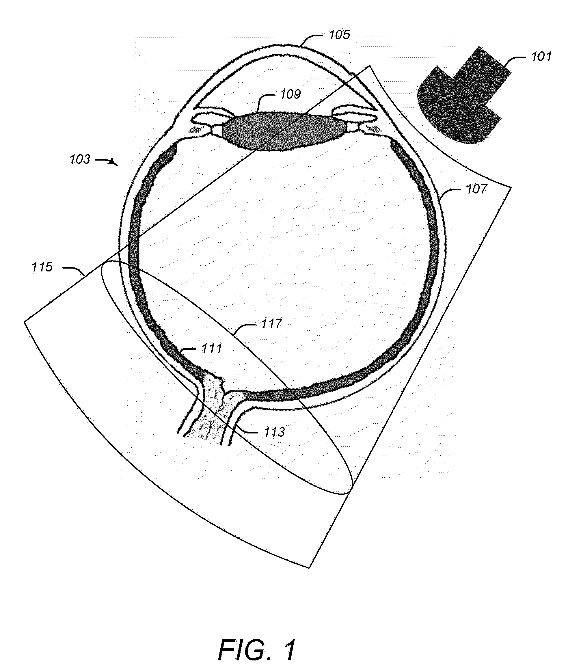 High frequency ultrasonic convex array transducers and tissue imaging