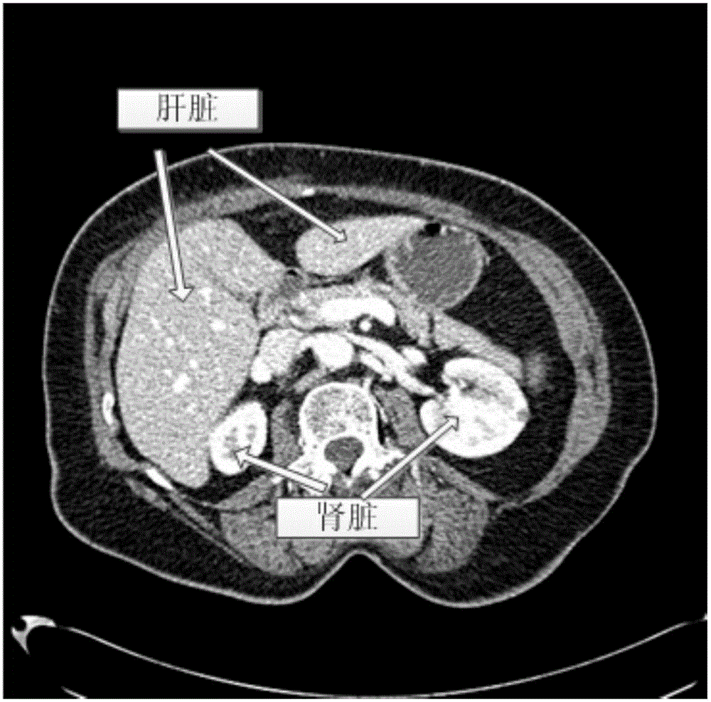 Multiple organ segmentation method based on deep convolutional neural network and regional competition model