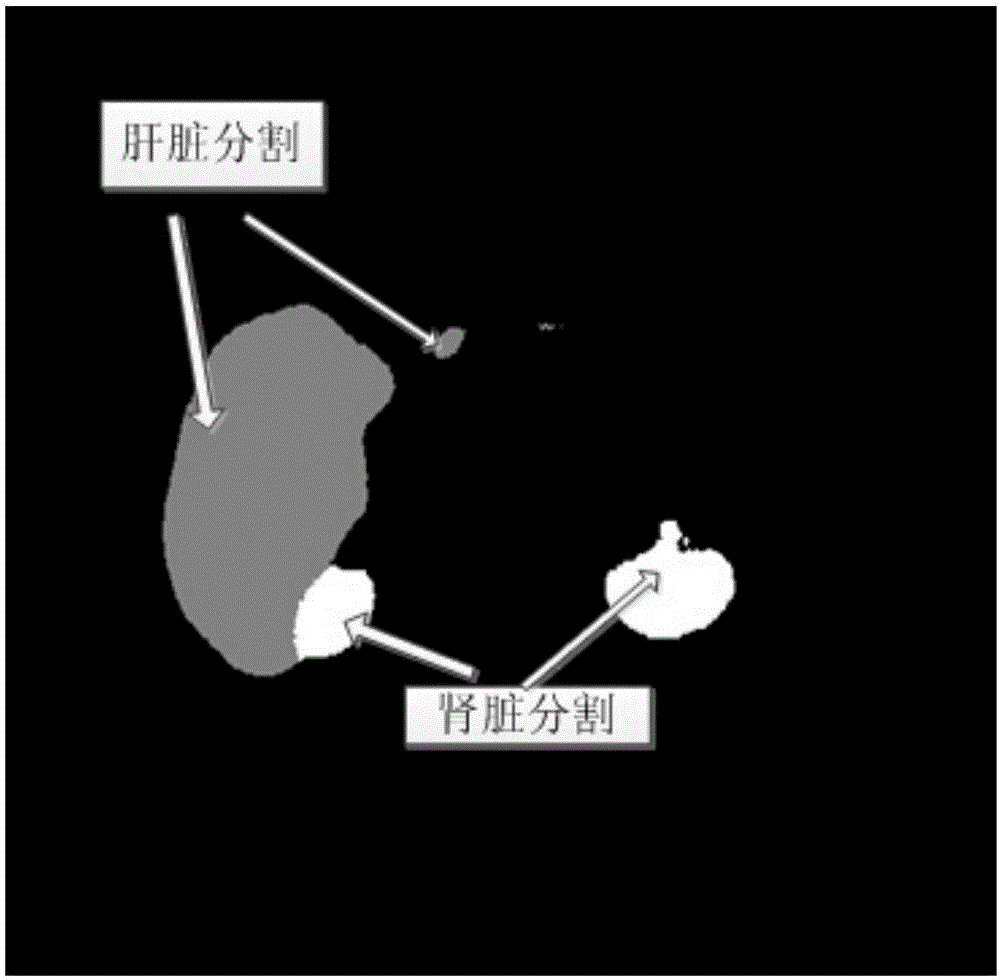 Multiple organ segmentation method based on deep convolutional neural network and regional competition model