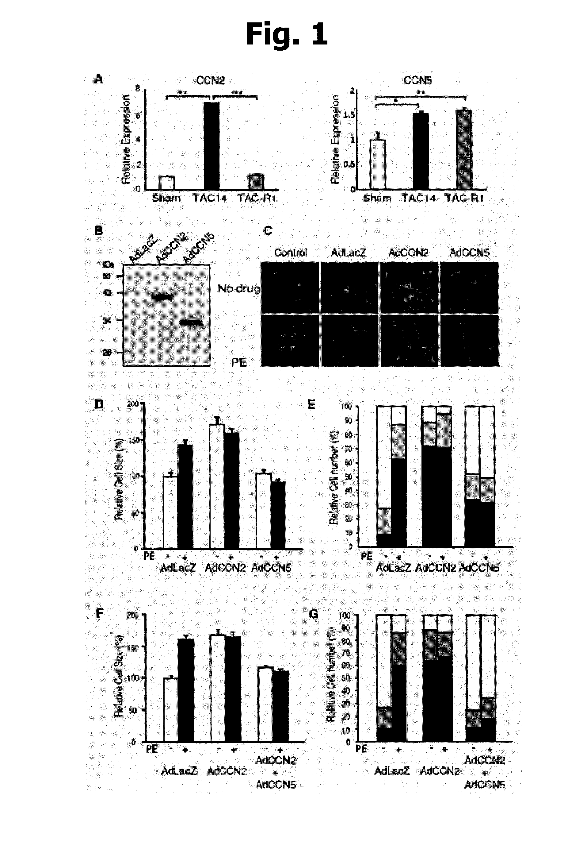 Pharmaceutical composition for preventing or treating heart failure and method for screening agent for preventing or treating heart failure