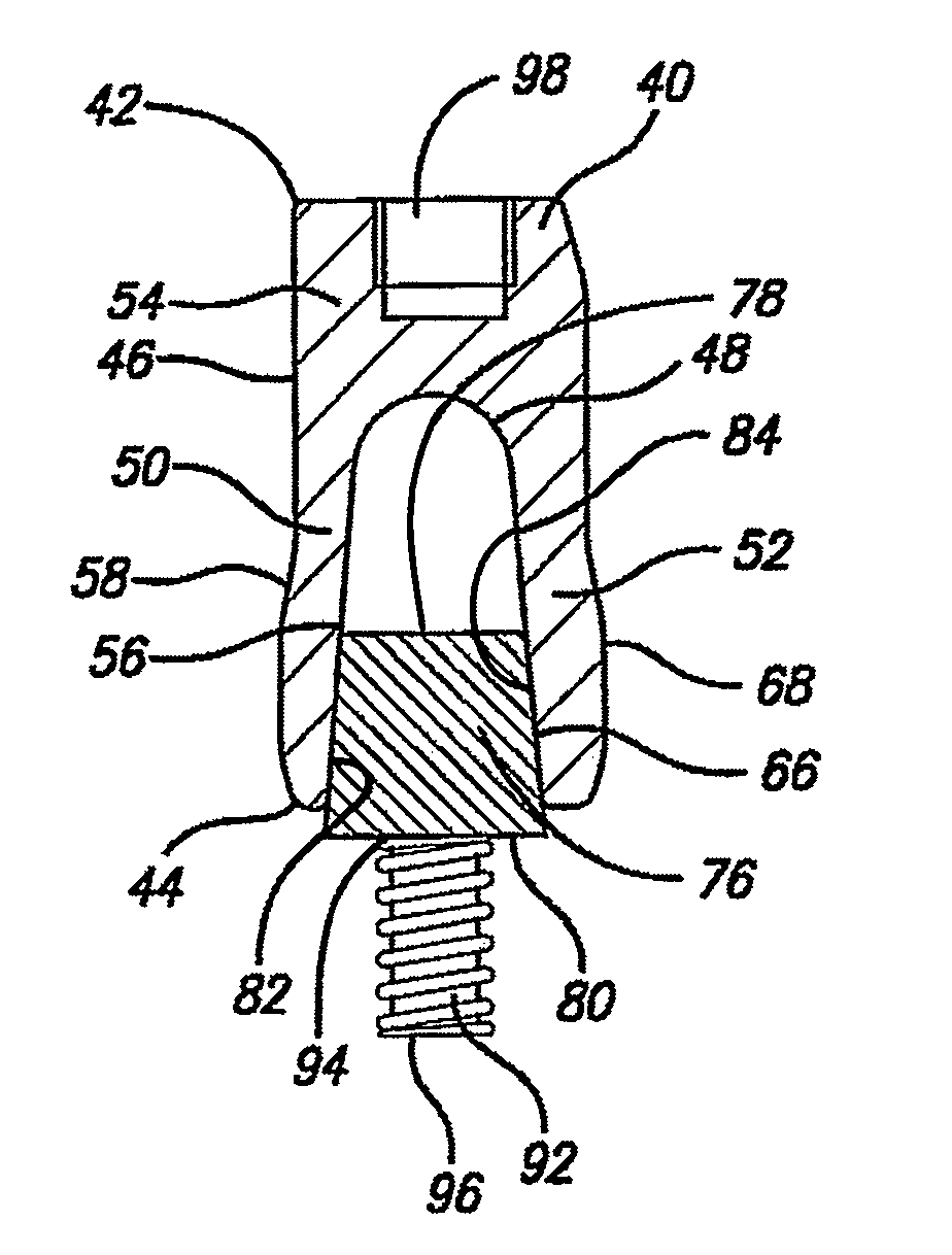 Metal valve stem and sealing system