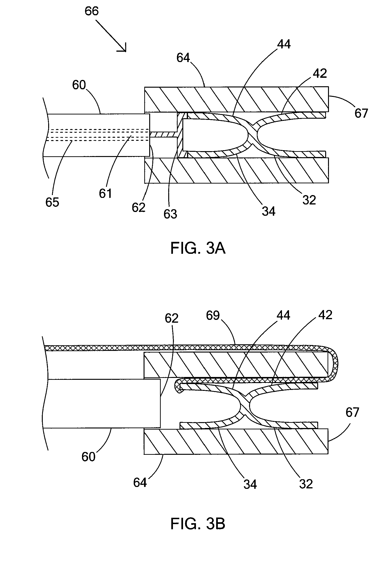 Planar clamps for anastomosis