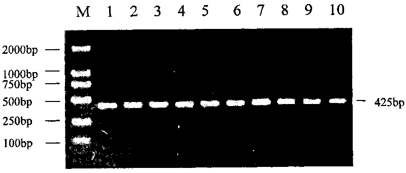 Single nucleotide polymorphism of GHRHR genes in dairy goat and detection method thereof