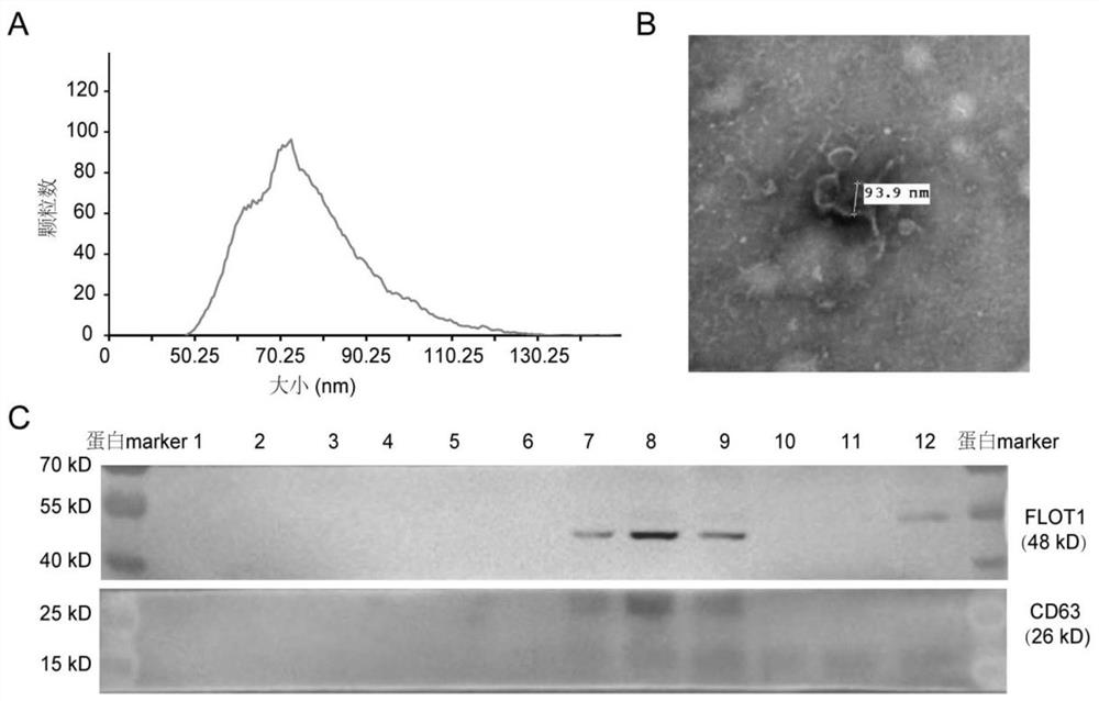 Biomarker, kit and detection method for liver cancer diagnosis