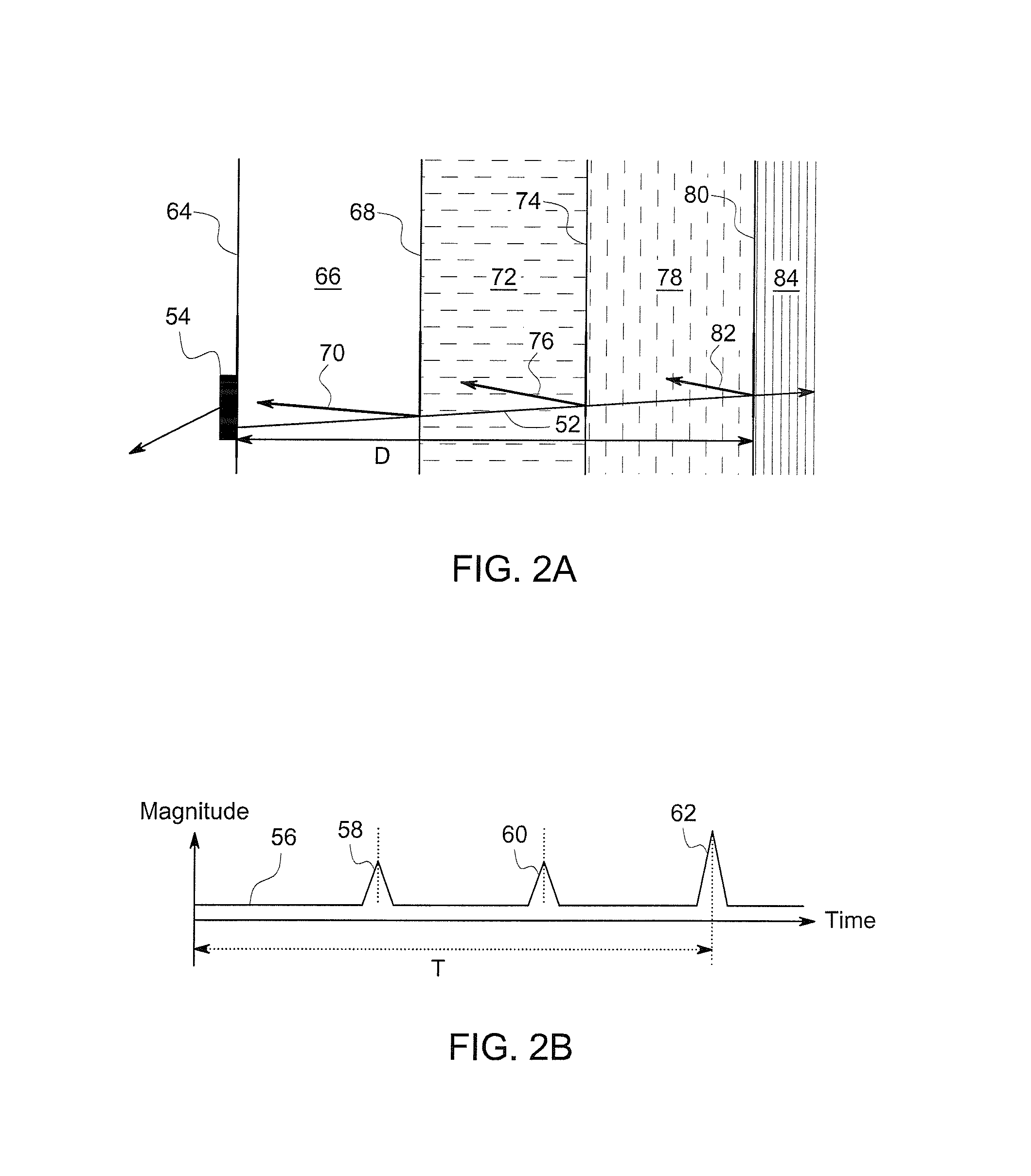 Abdominal sonar system and apparatus