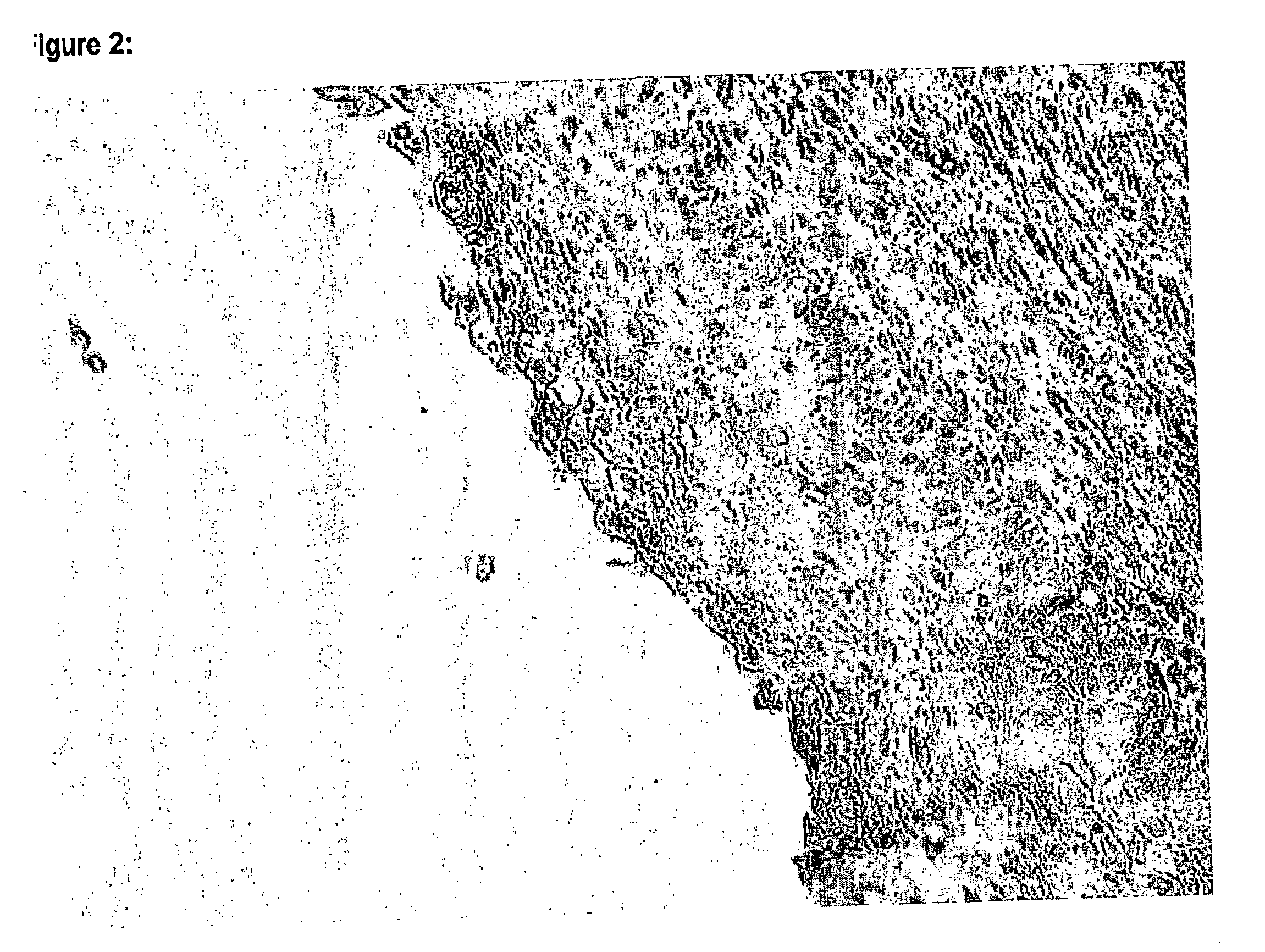 Compositions and methods for diagnosis and therapy of cancers